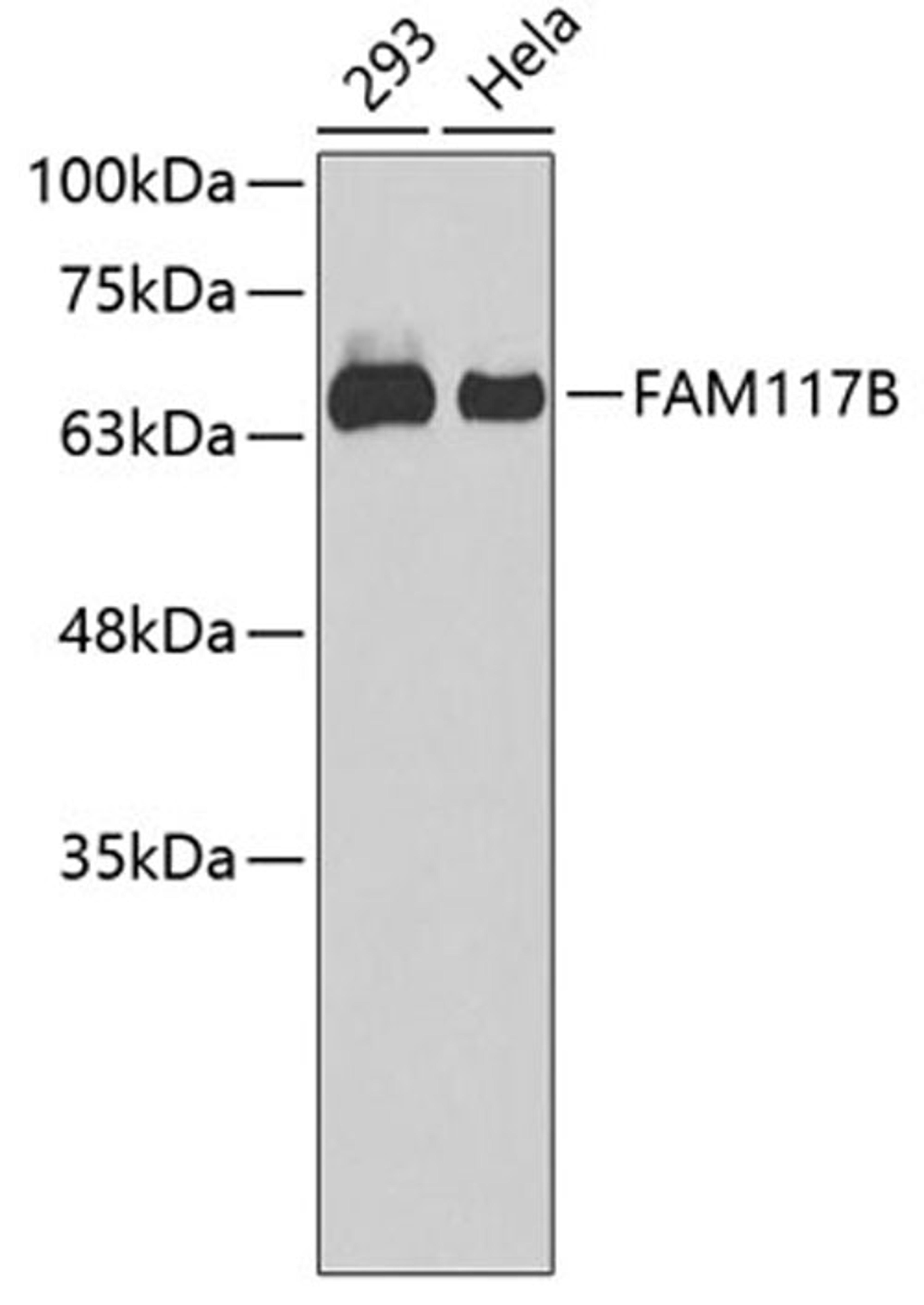 Western blot - FAM117B antibody (A3551)