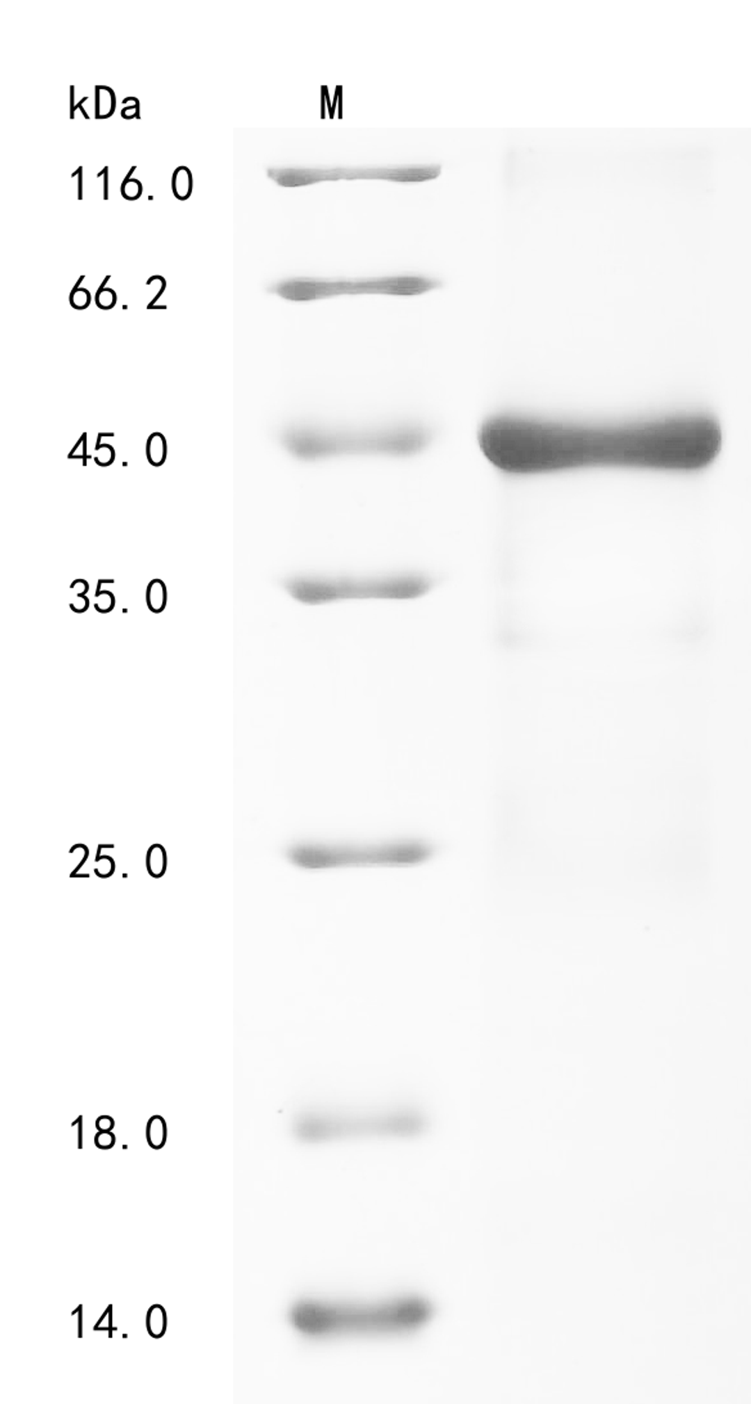 (Tris-Glycine gel) Discontinuous SDS-PAGE (reduced) with 5% enrichment gel and 15% separation gel.