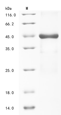 (Tris-Glycine gel) Discontinuous SDS-PAGE (reduced) with 5% enrichment gel and 15% separation gel.