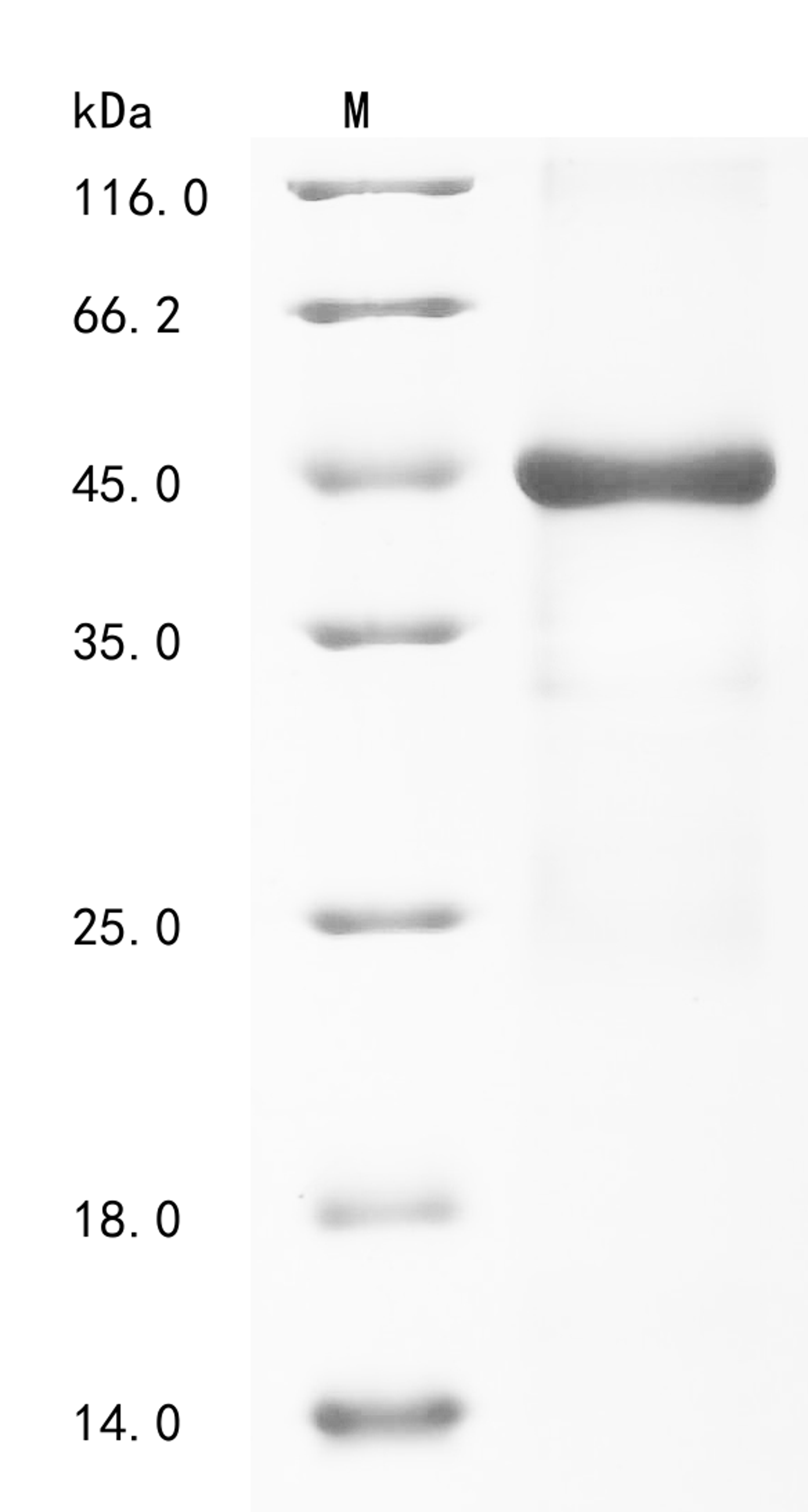 (Tris-Glycine gel) Discontinuous SDS-PAGE (reduced) with 5% enrichment gel and 15% separation gel.