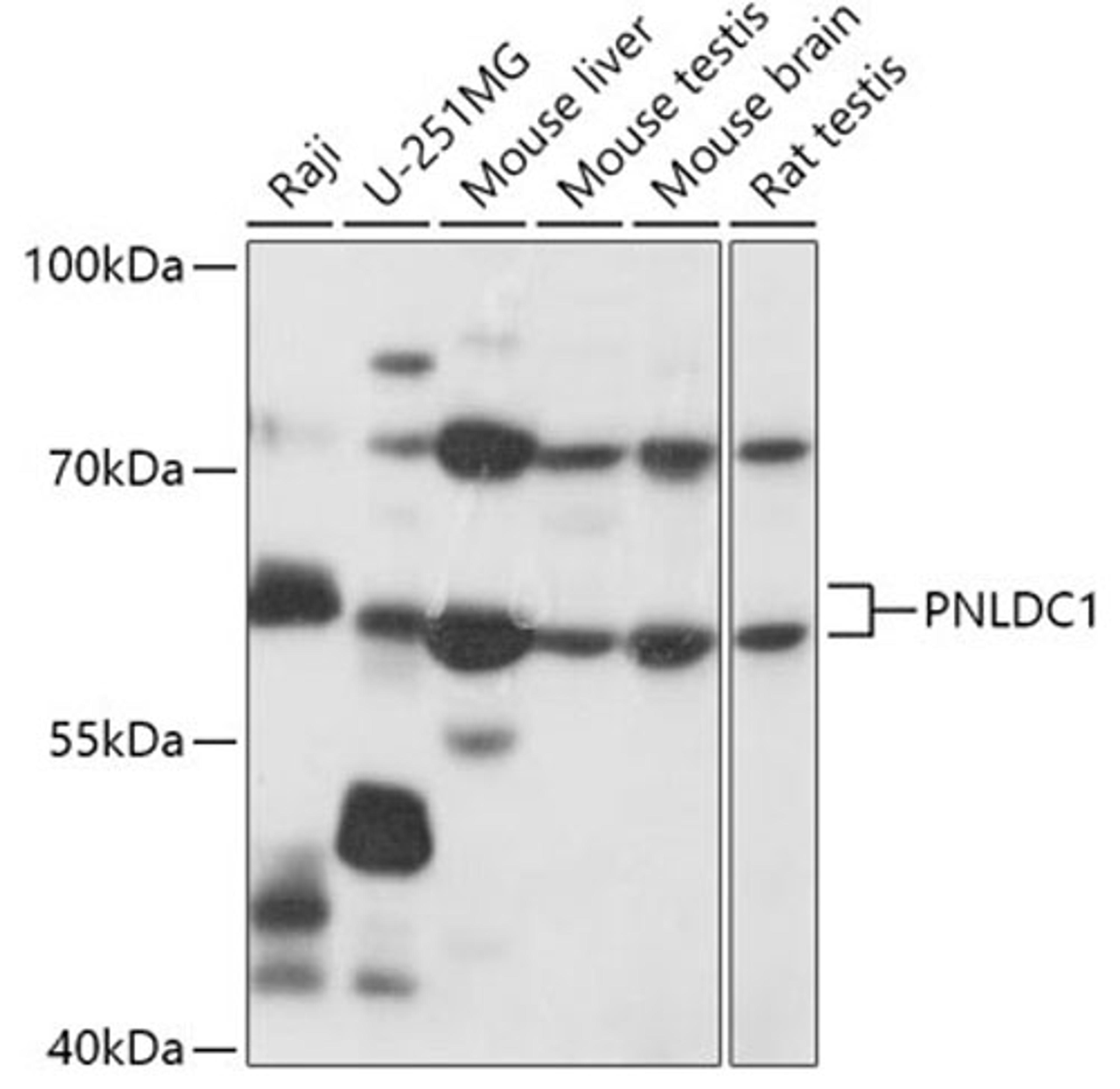 Western blot - PNLDC1 antibody (A17838)