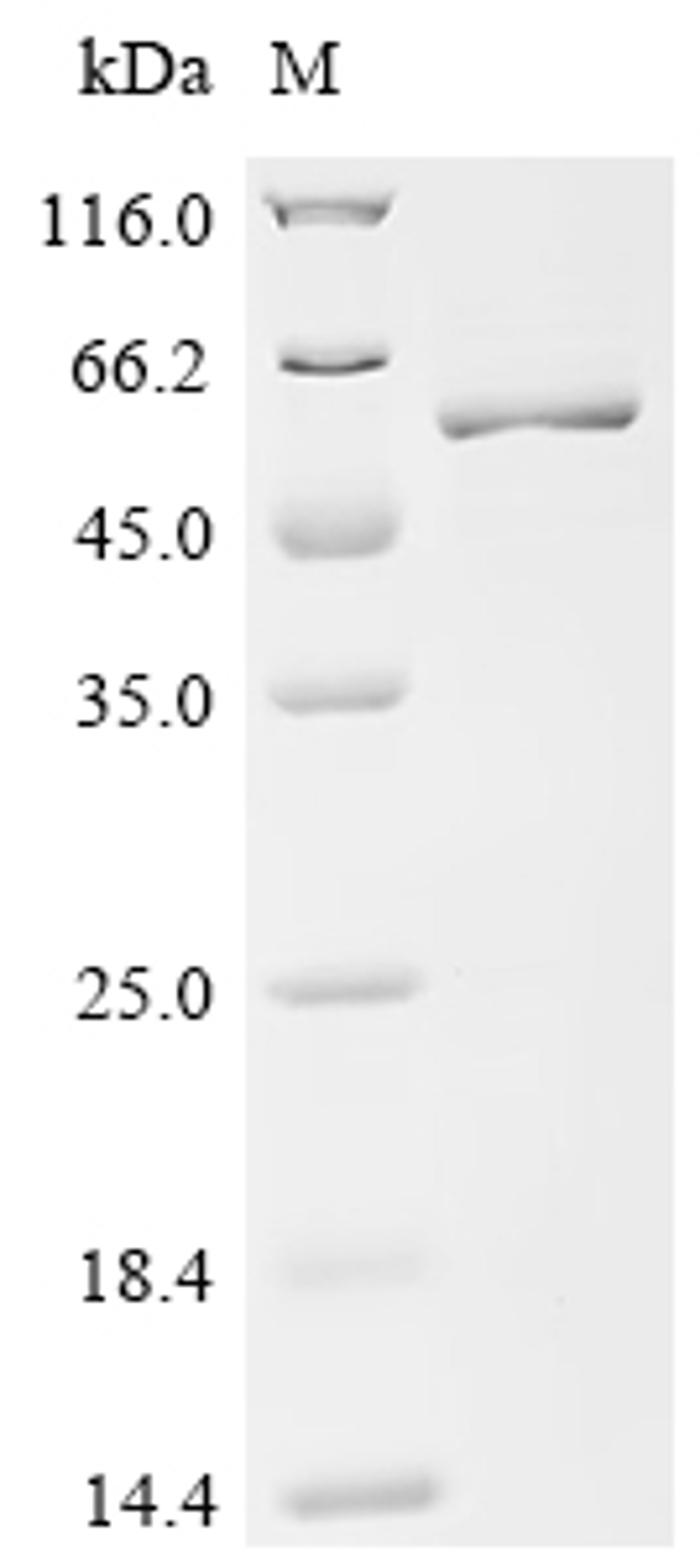(Tris-Glycine gel) Discontinuous SDS-PAGE (reduced) with 5% enrichment gel and 15% separation gel.
