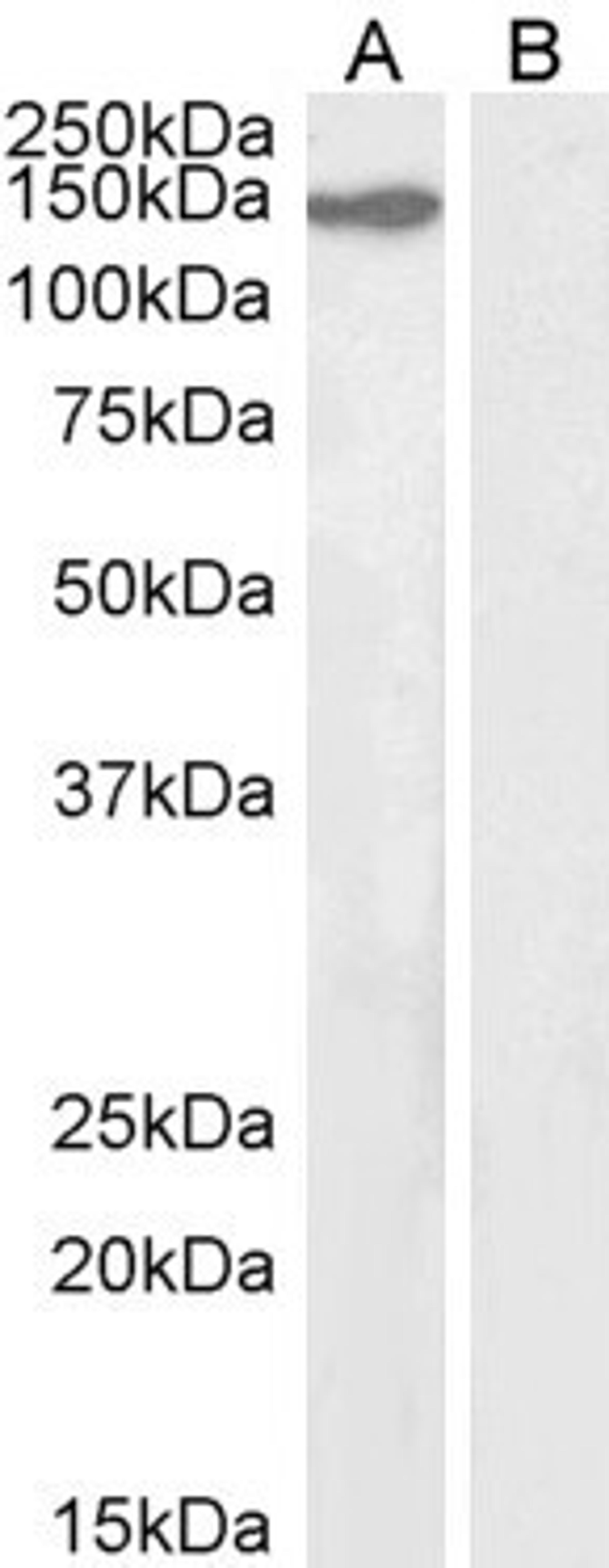 45-798 (2ug/ml) staining of nuclear NIH3T3 (A) and (2ug/ml) negative control Human Ovary (B) lysate. (35ug protein in RIPA buffer) Detected by chemiluminescence.