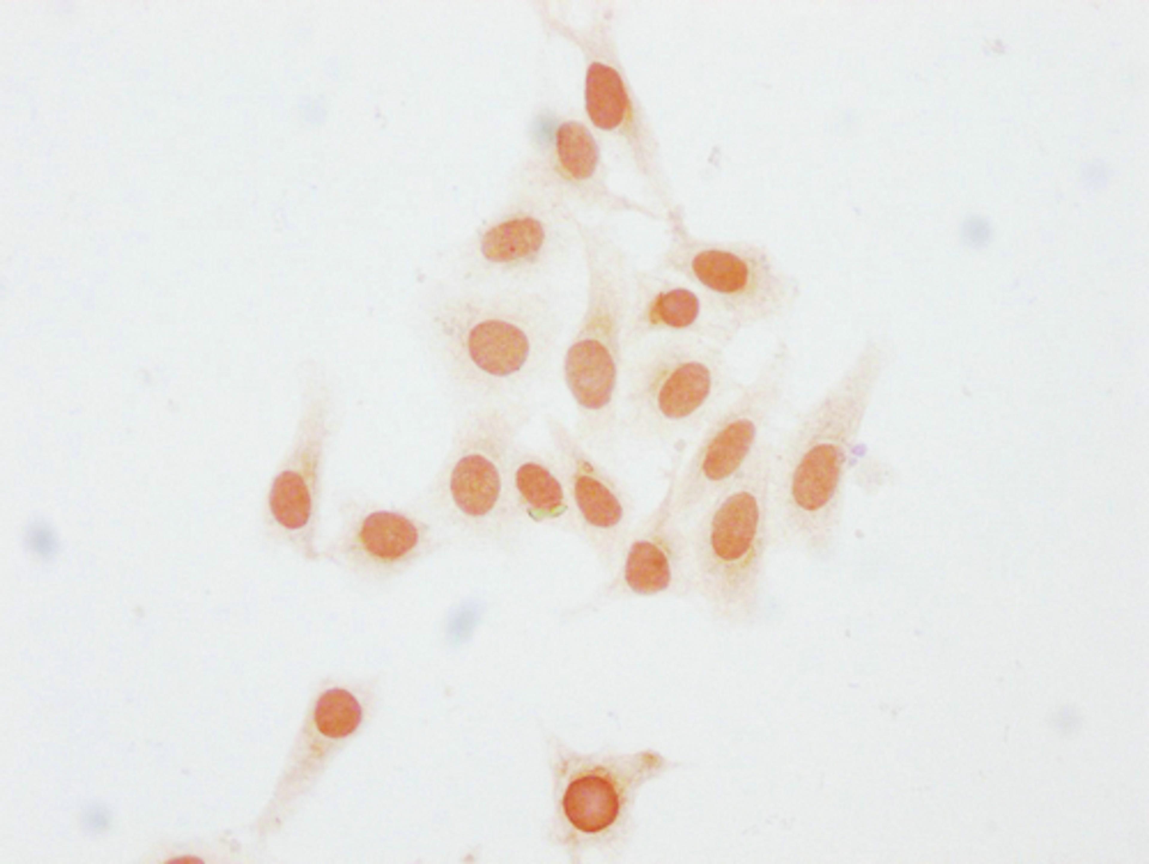 Immunocytochemistry analysis of CSB-PA010403PA23me1HU diluted at 1:15 and staining in Hela cells performed on a Leica BondTM system. The cells were fixed in 4% formaldehyde, permeabilized using 0.2% Triton X-100 and blocked with 10% normal goat serum 30min at RT. Then primary antibody (1% BSA) was incubated at 4°C overnight. The primary is detected by a biotinylated secondary antibody and visualized using an HRP conjugated SP system.