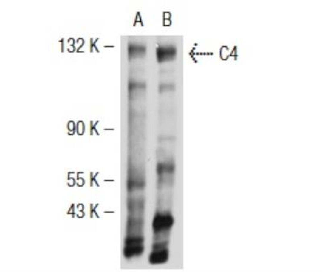 Western Blot: Complement C4b/d Antibody (16D2) [NB200-541] - Western blot analysis of C4 expression in J774.A1 (A) aand mouse PBL (B) whole cell lysates.