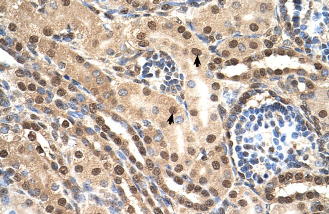 Antibody used in IHC on Human kidney lysate.