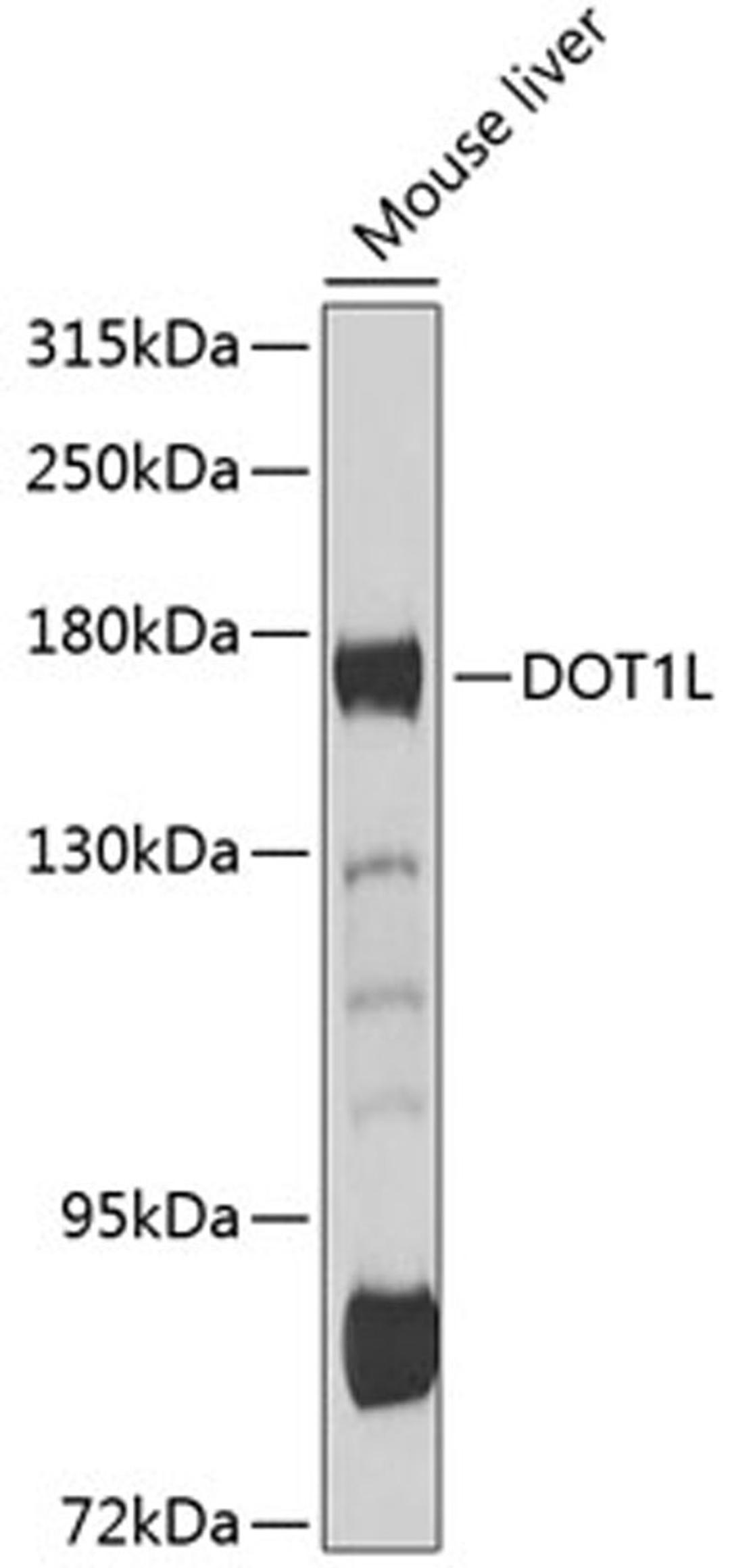 Western blot - DOT1L antibody (A11285)