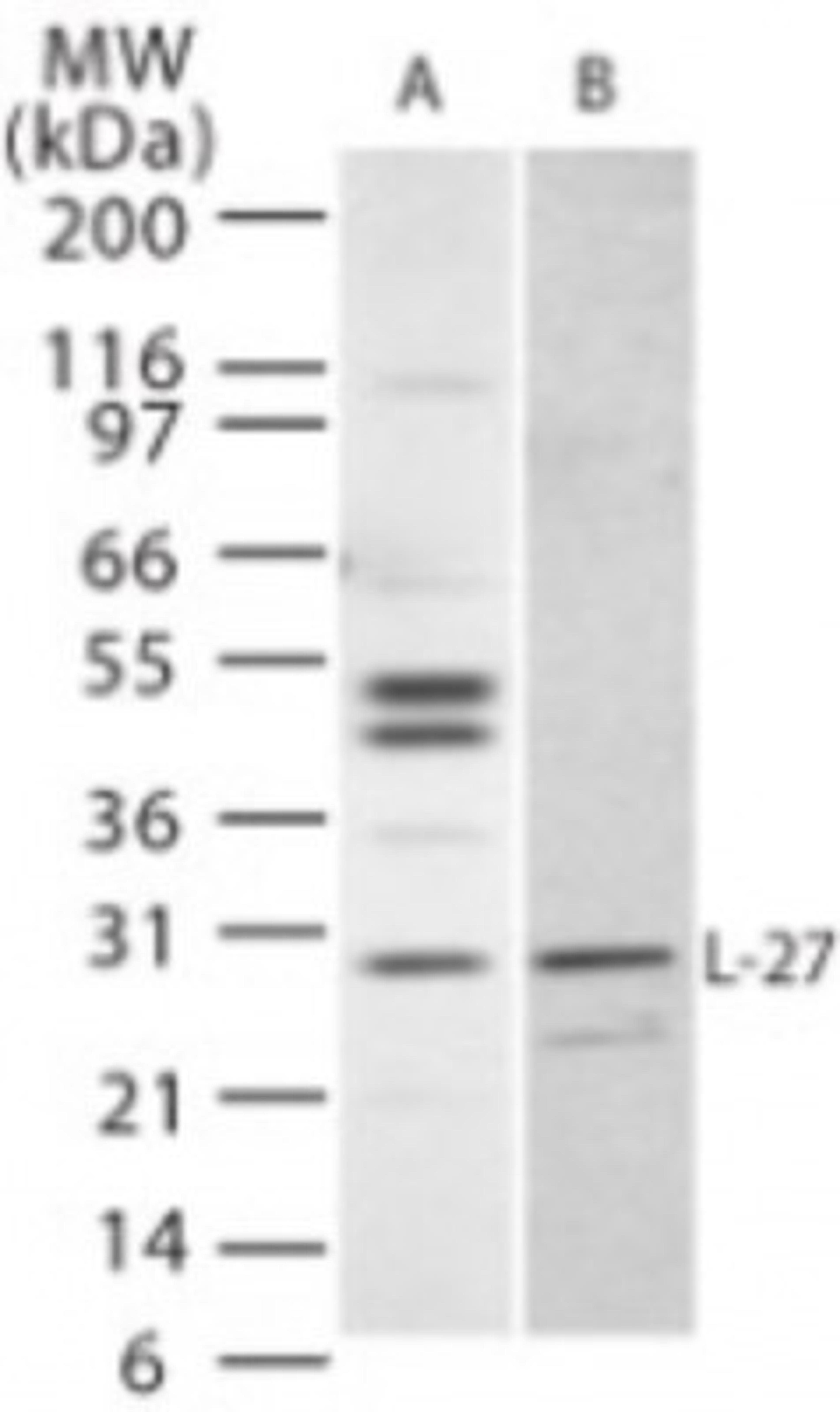 Western Blot: IL27 Antibody [NB100-56389] - Analysis of IL-27 in (A) Jurkat and (B) NIH 3T3 cells using IL-27 antibody at 1 ug/ml.