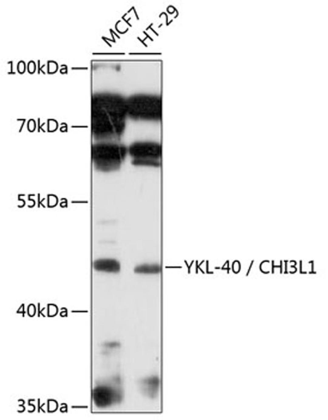 Western blot - YKL-40 / CHI3L1 antibody (A3166)