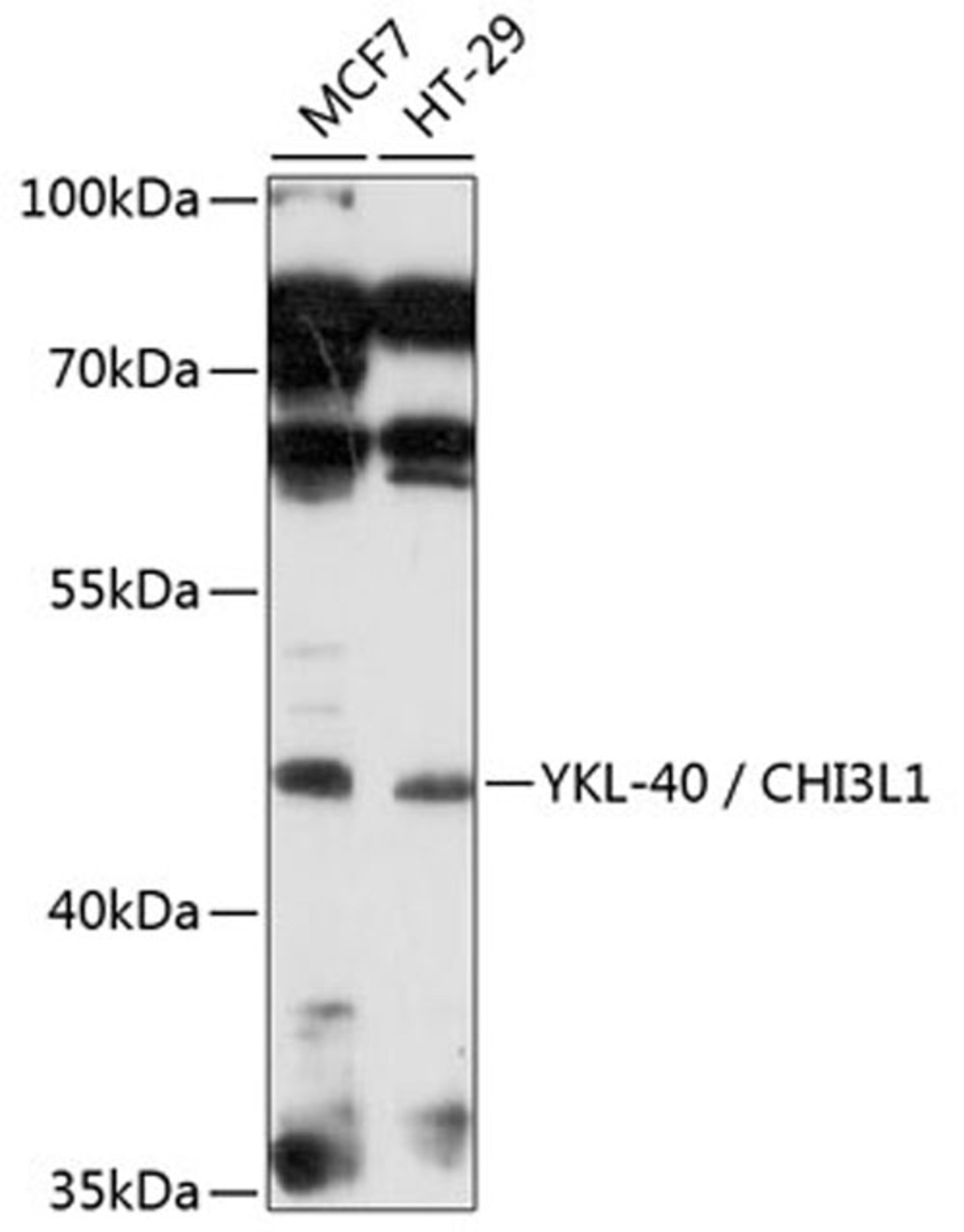 Western blot - YKL-40 / CHI3L1 antibody (A3166)