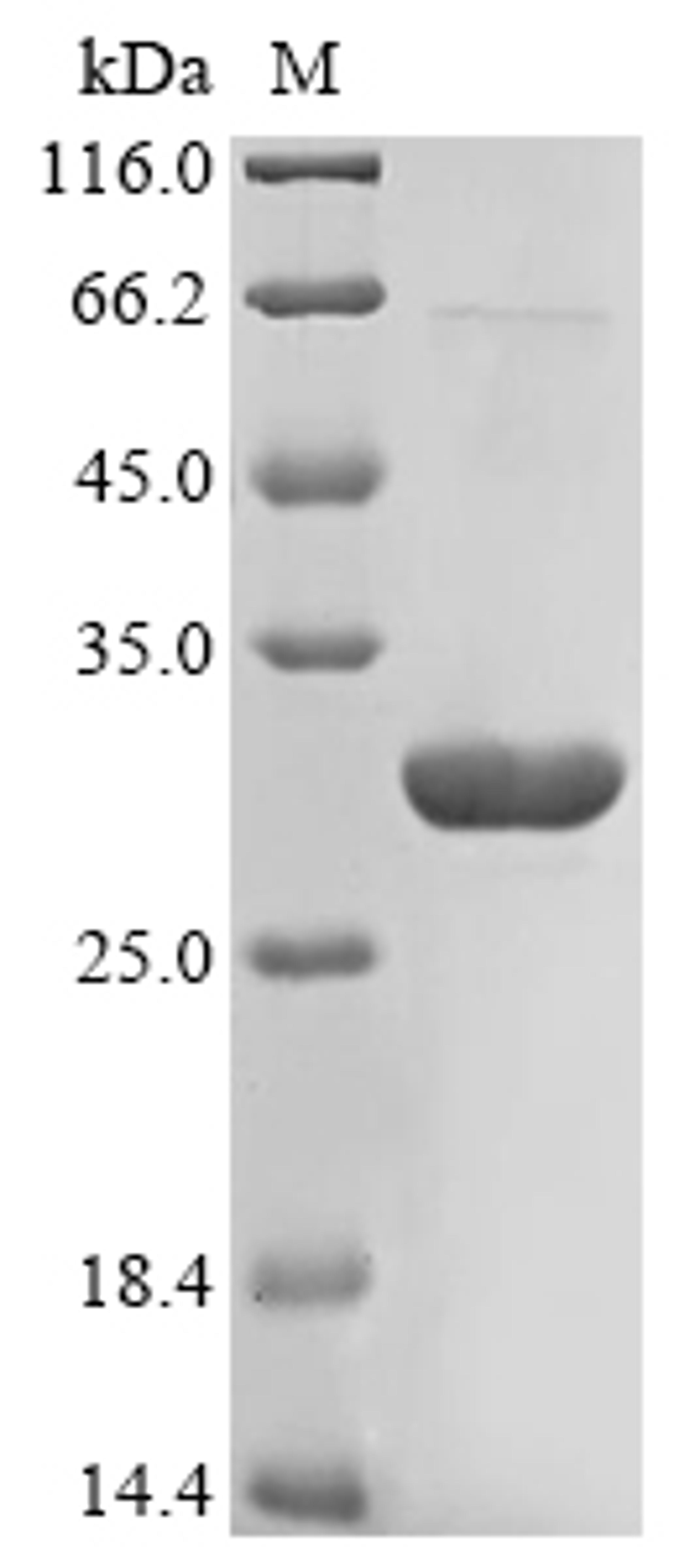 (Tris-Glycine gel) Discontinuous SDS-PAGE (reduced) with 5% enrichment gel and 15% separation gel.