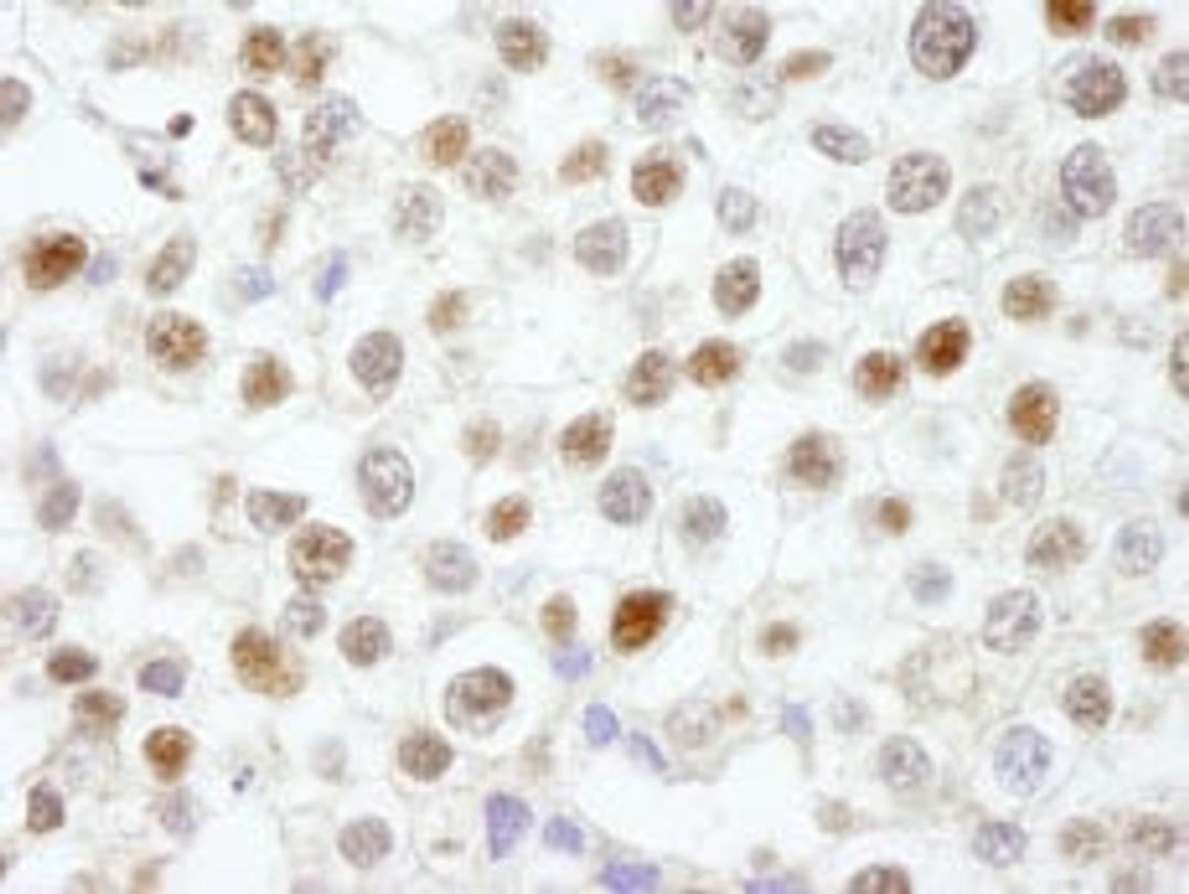 Detection of human Fen1 by immunohistochemistry.