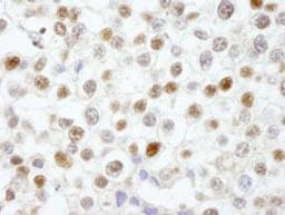 Detection of human Fen1 by immunohistochemistry.