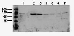 Western blot analysis of Phosphotyrosine antibody in Whole cell lysates