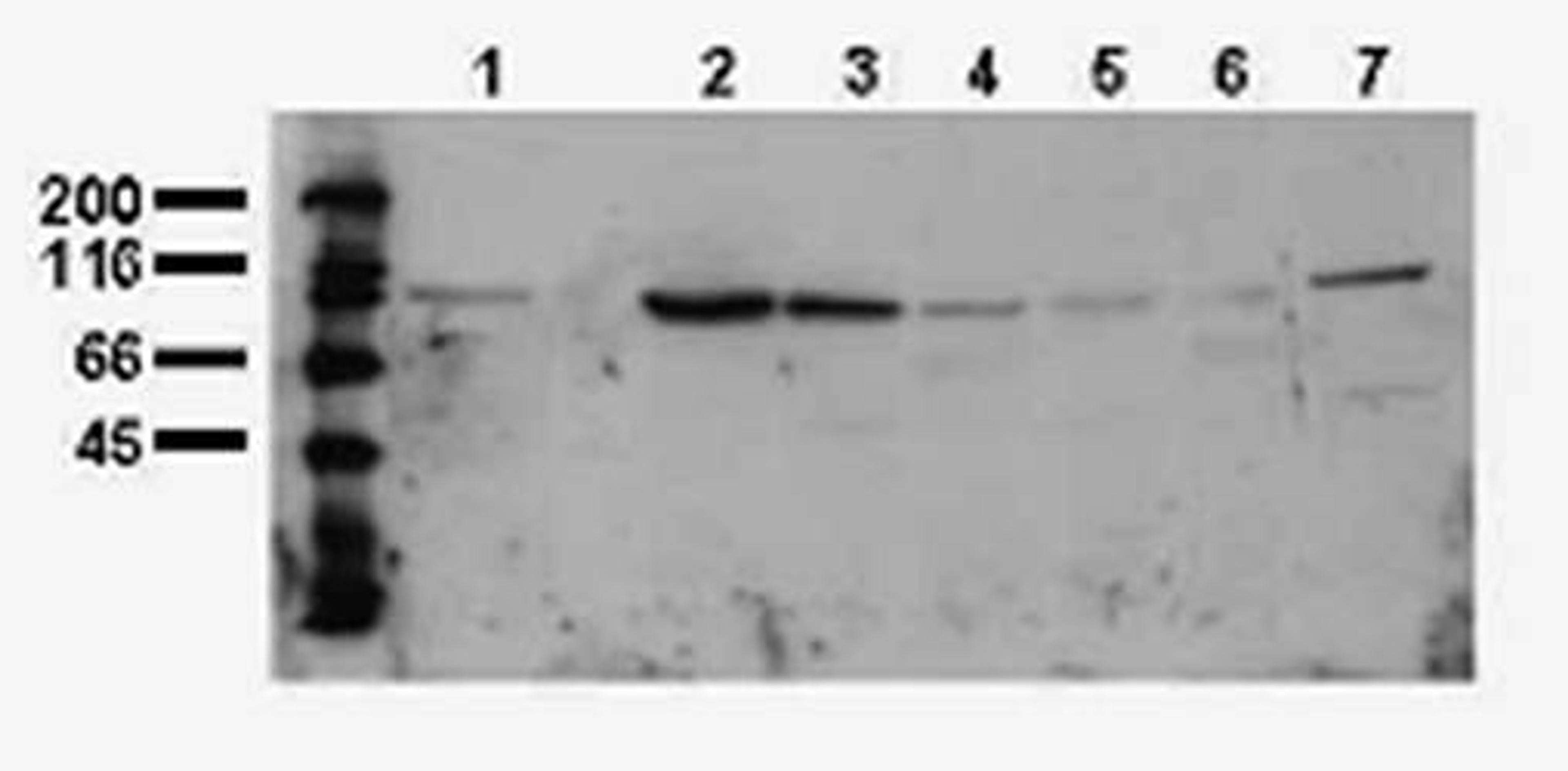 Western blot analysis of Phosphotyrosine antibody in Whole cell lysates