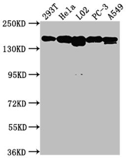 Western Blot. Positive WB detected in: 293T whole cell lysate, Hela whole cell lysate, L02 whole cell lysate, PC-3 whole cell lysate, A549 whole cell lysate. All lanes: MET antibody at 1:1500. Secondary. Goat polyclonal to rabbit IgG at 1/50000 dilution. Predicted band size: 156, 158, 86 kDa. Observed band size: 156 kDa. 