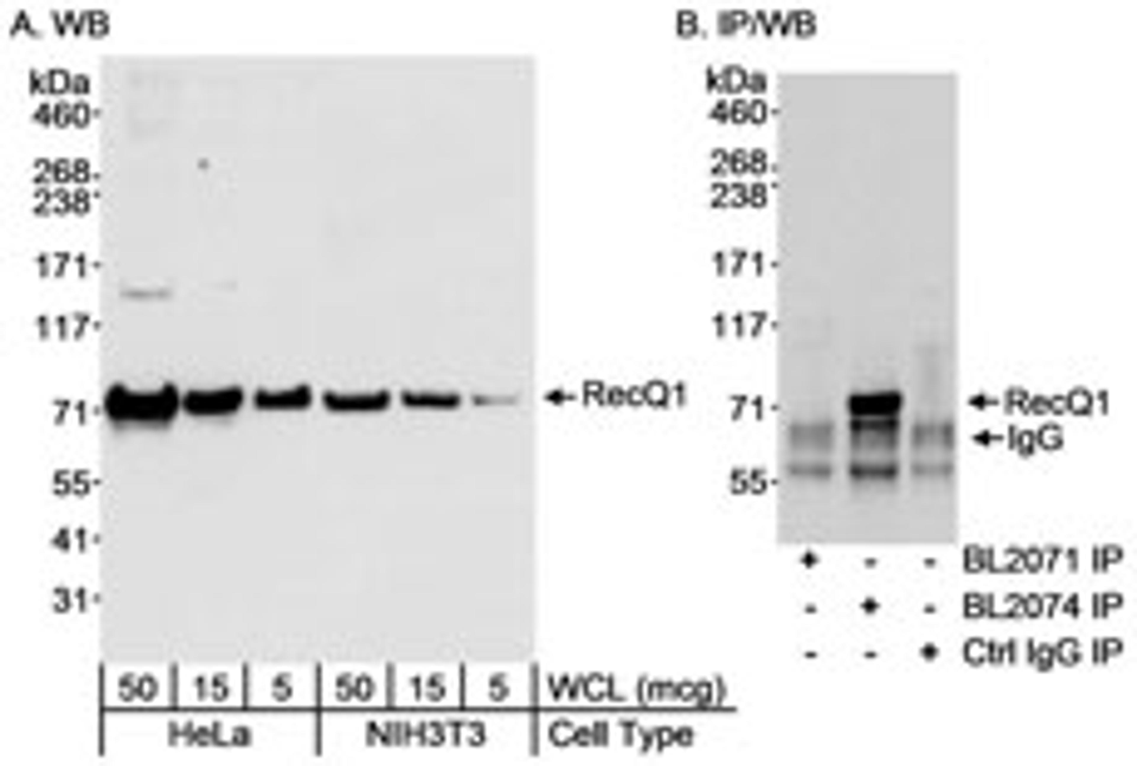 Detection of human and mouse RecQ1 by western blot and human ReqQ1 by immunoprecipitation.