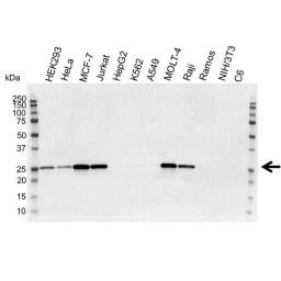 Western blot analysis of whole cell lysates probed with bcl-2 antibody