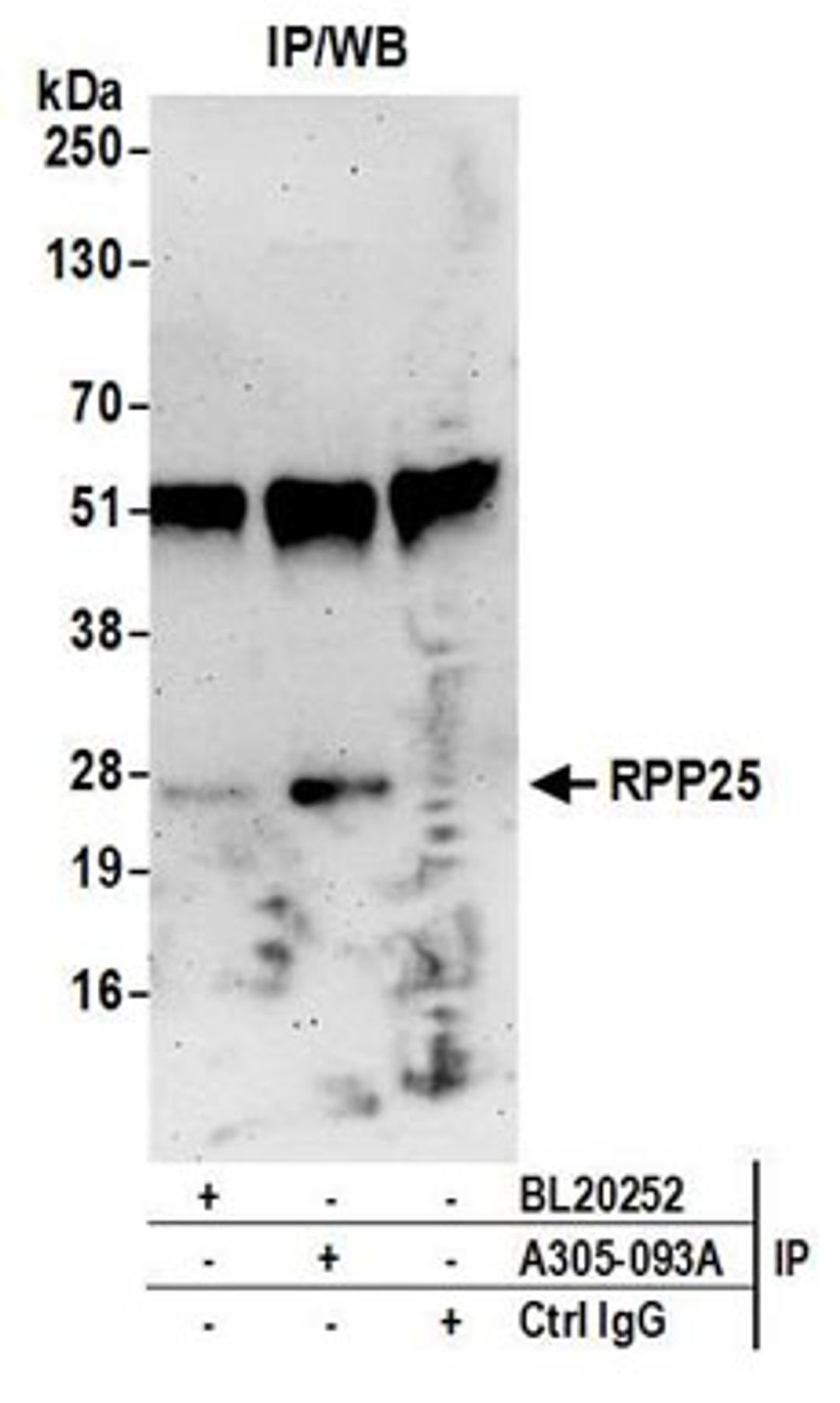 Detection of human RPP25 by western blot of immunoprecipitates.