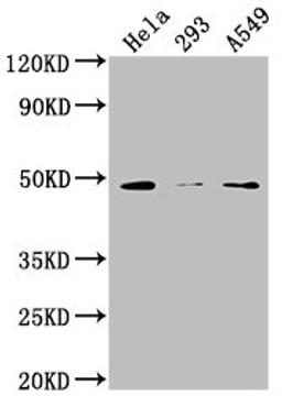 Western Blot. Positive WB detected in: Hela whole cell lysate, 293 whole cell lysate, A549 whole cell lysate. All lanes: NXN antibody at 1:2000. Secondary. Goat polyclonal to rabbit IgG at 1/50000 dilution. Predicted band size: 49, 21, 37 kDa. Observed band size: 49 kDa.