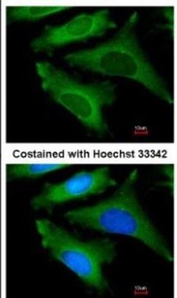 Immunocytochemistry/Immunofluorescence: IL-1ra/IL-1F3/IL1RN Antibody [NBP1-32568] -  Analysis of methanol-fixed HeLa, using antibody at 1:200 dilution.