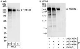 Detection of human TAB182 by western blot and immunoprecipitation.