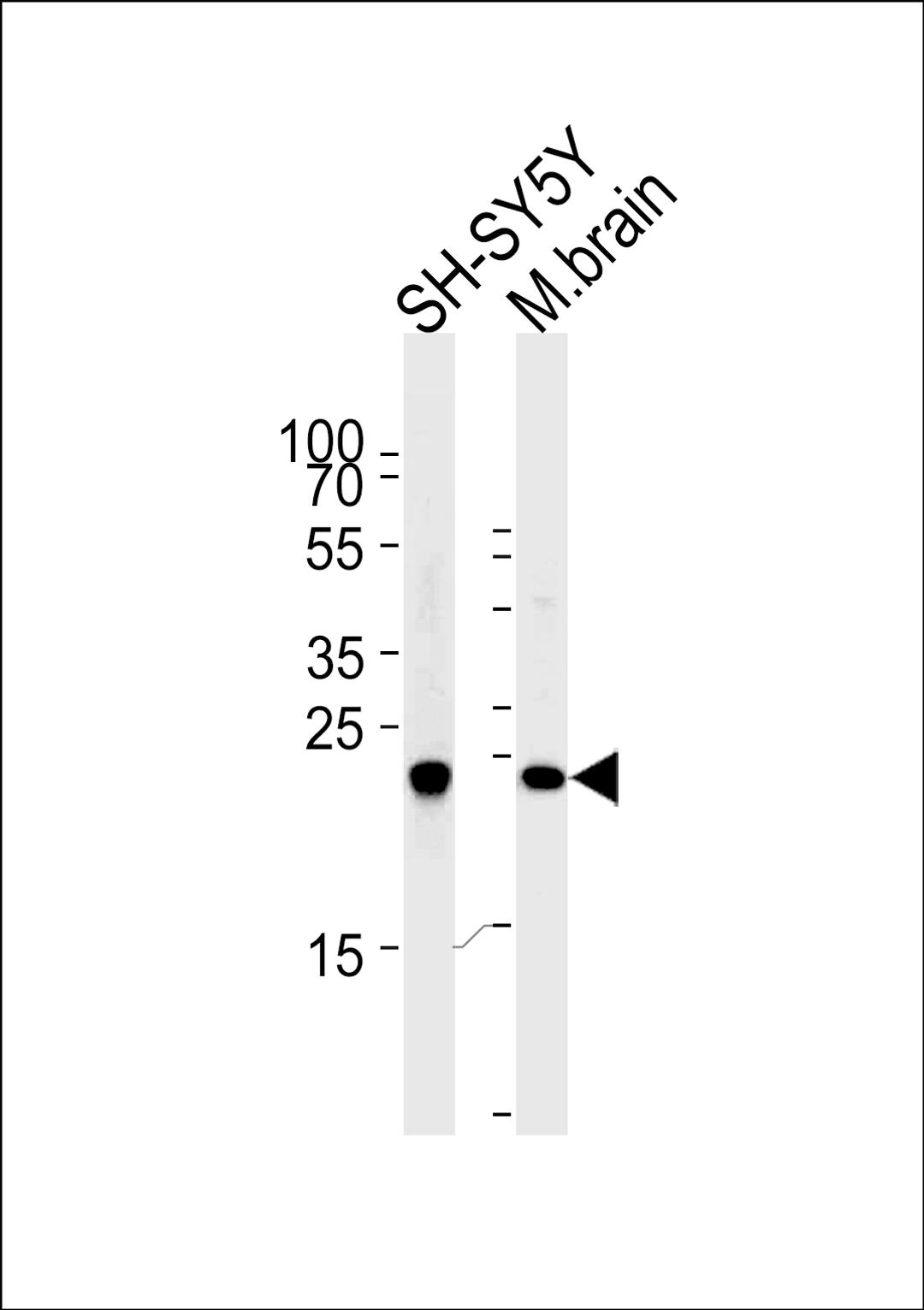 Western blot analysis of lysates from SH-SY5Y cell line and mouse brain tissue (from left to right),using UCHL1 Antibody .AP2126e was diluted at 1:1000 at each lane.