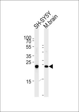 Western blot analysis of lysates from SH-SY5Y cell line and mouse brain tissue (from left to right),using UCHL1 Antibody .AP2126e was diluted at 1:1000 at each lane.