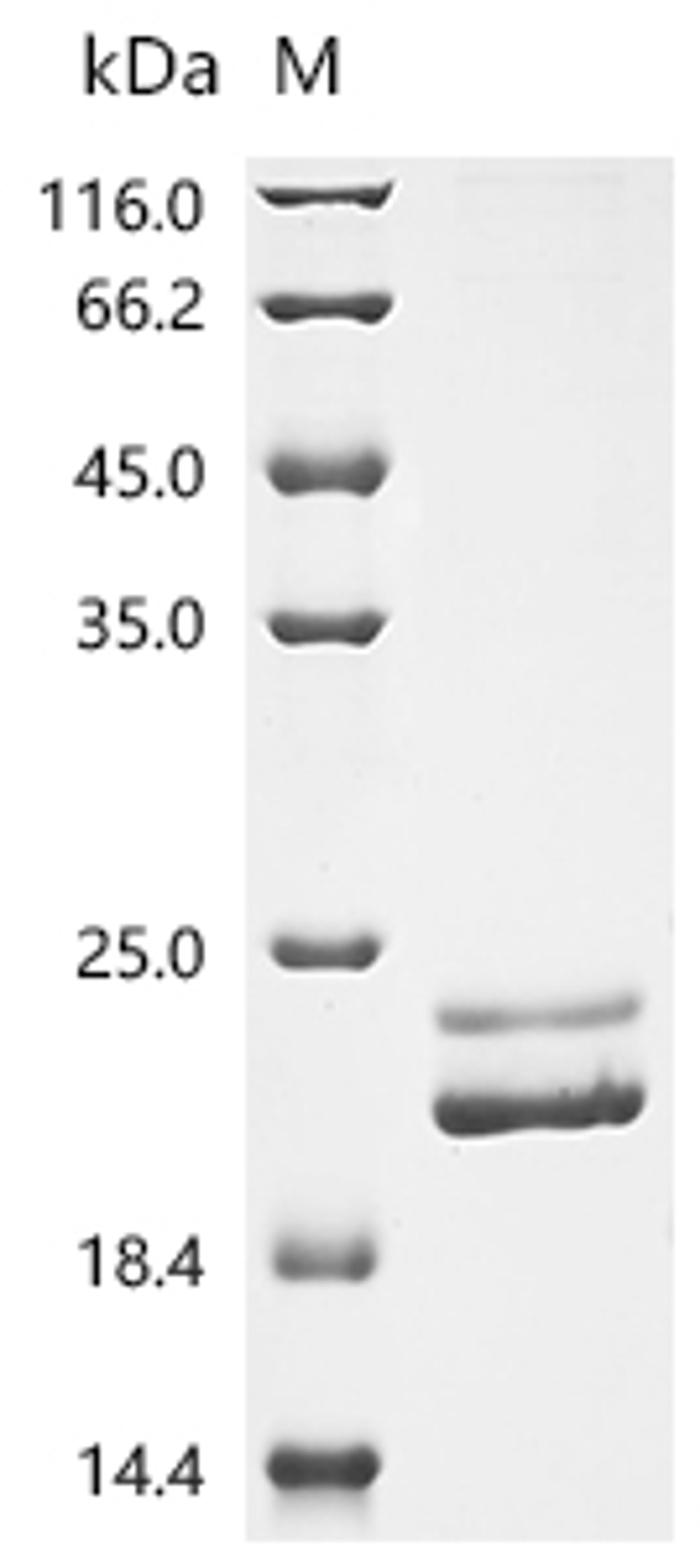 (Tris-Glycine gel) Discontinuous SDS-PAGE (reduced) with 5% enrichment gel and 15% separation gel.
