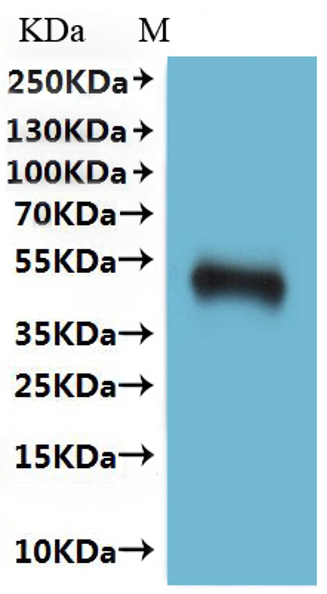 CSB-MP004844HU is detected by Mouse anti-6*His monoclonal antibody.(This tag can be tested only under denaturing conditions.)