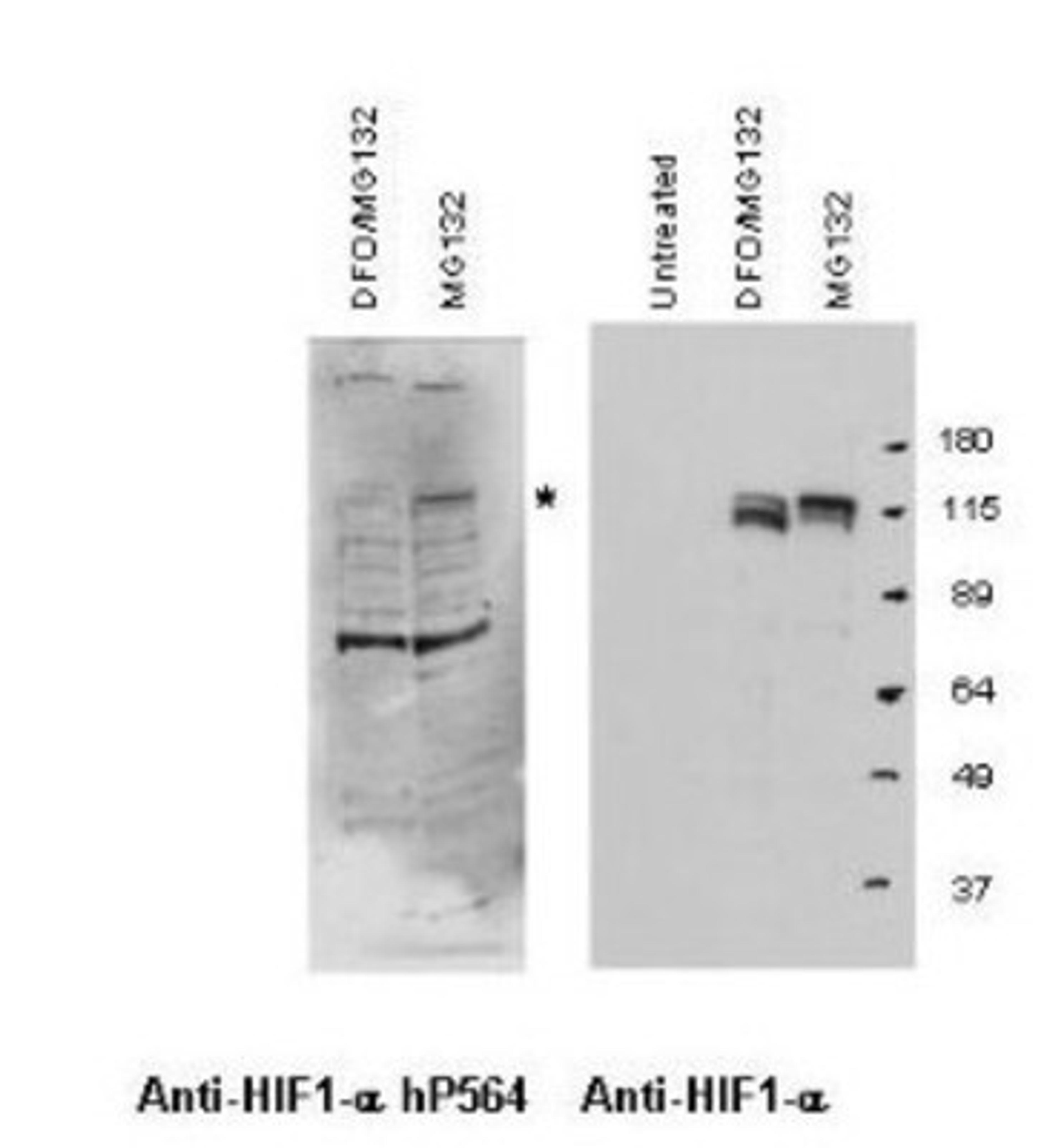 Western Blot: HIF-1 alpha [Hydroxy Pro564] Antibody [NB110-74679] - HIF-1alpha HYDROXYP564 antibody shows detection (left panel) of hydroxylated HIF-1alpha in nuclear extracts of A549 cells treated with MG132 (a proteosome inhibitor). Hydroxyproline is not recognized on HIF-1alpha when cells are first treated with DFO, a prolyl hydroxylase inhibitor that prevents HIF hydroxylation. Control staining is shown (right panel) using conventional anti-HIF-1alpha. The asterisk marks a band approximately 110 kDa in size corresponding to HIF1-alpha. The primary antibody was used at a 1:1,000 dilution in 2% BLOTTO.