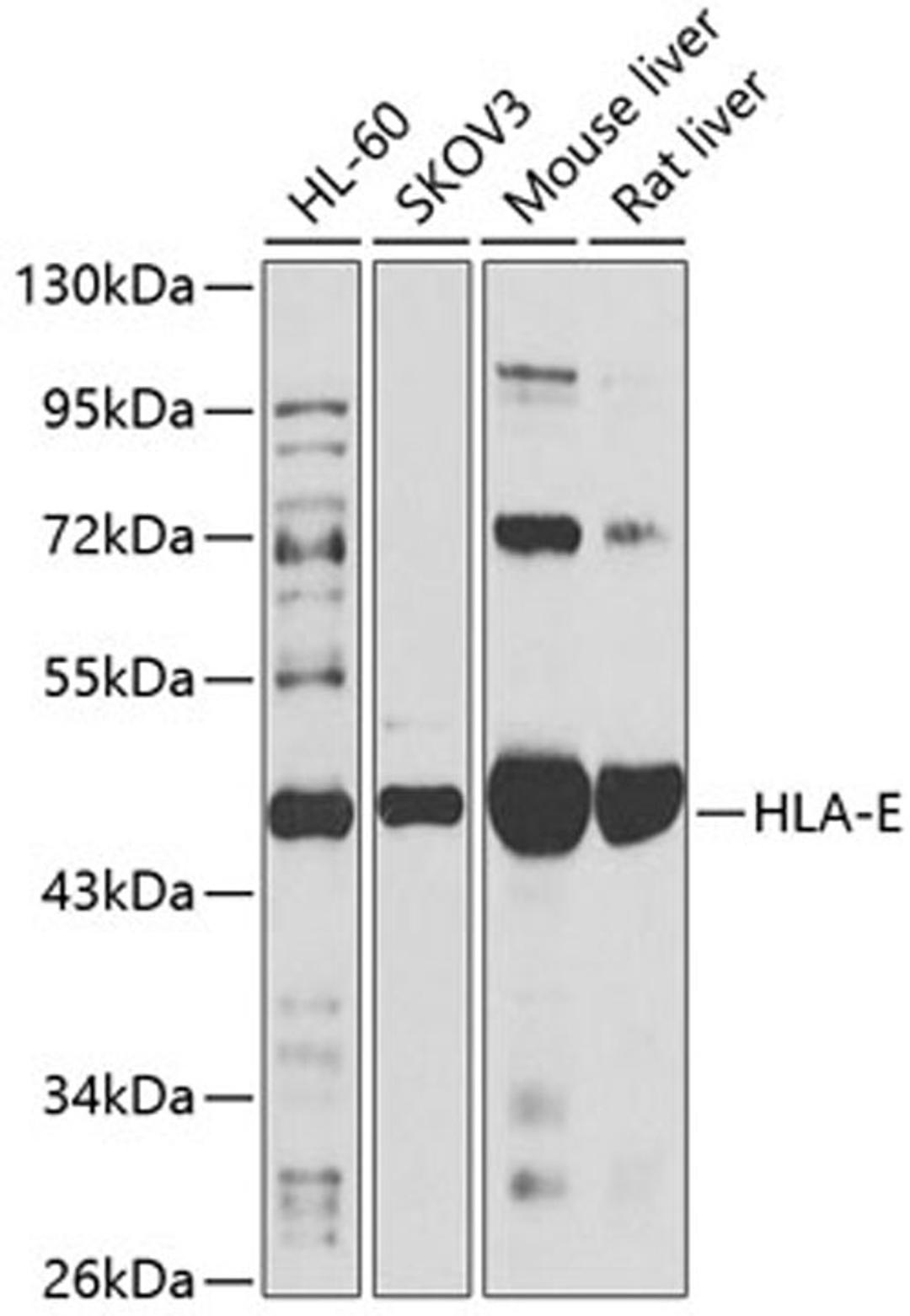 Western blot - HLA-E antibody (A14206)