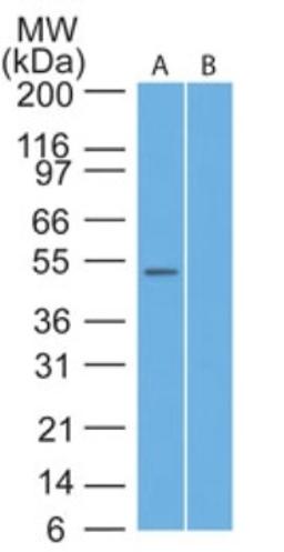 Western Blot: TRAF7 Antibody [NB600-1399] - analysis of TRAF7 in human Hela lysate in the A) absence and B) presence of immunizing peptide using TRAF7 antibody at 2 ug/ml.