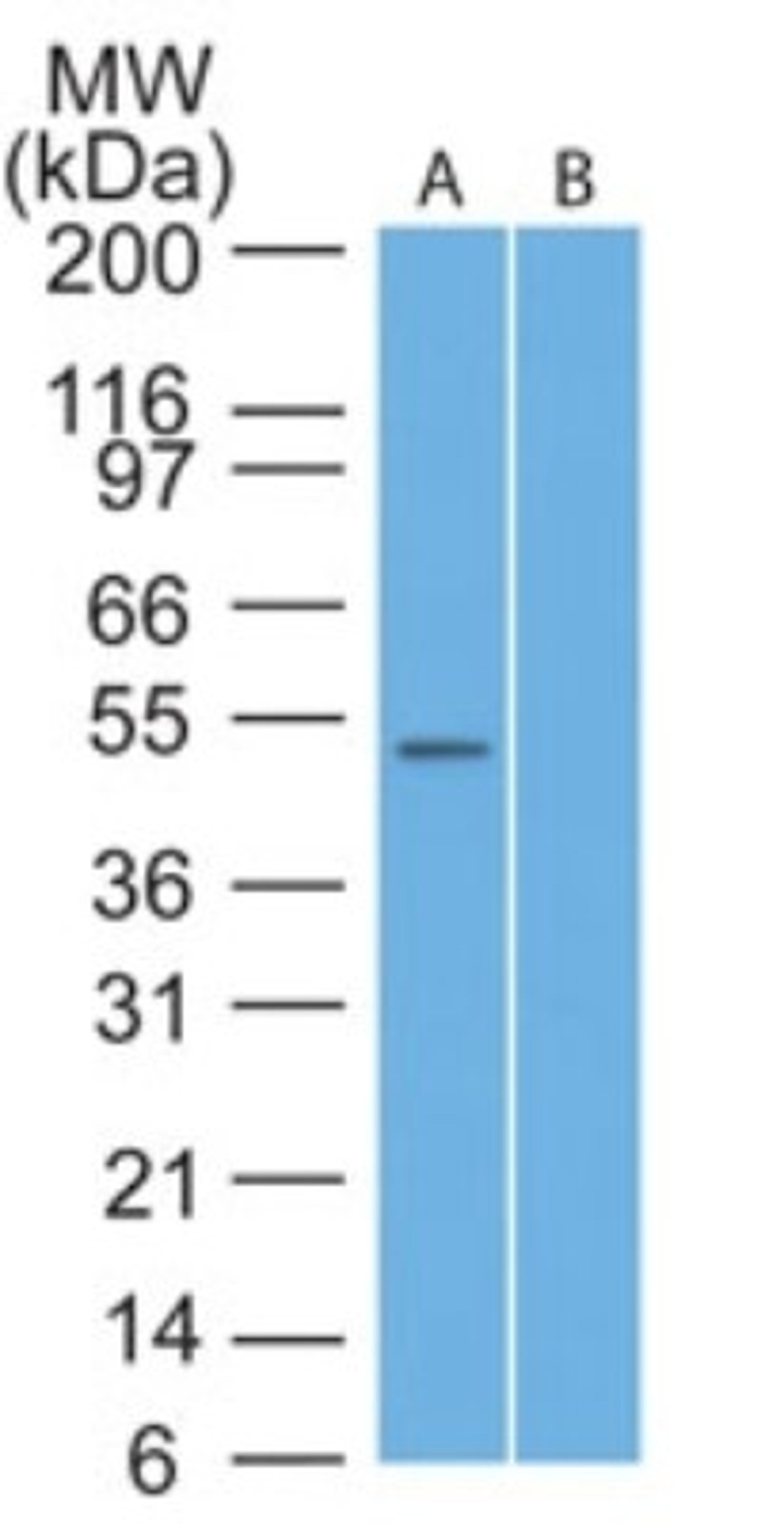 Western Blot: TRAF7 Antibody [NB600-1399] - analysis of TRAF7 in human Hela lysate in the A) absence and B) presence of immunizing peptide using TRAF7 antibody at 2 ug/ml.