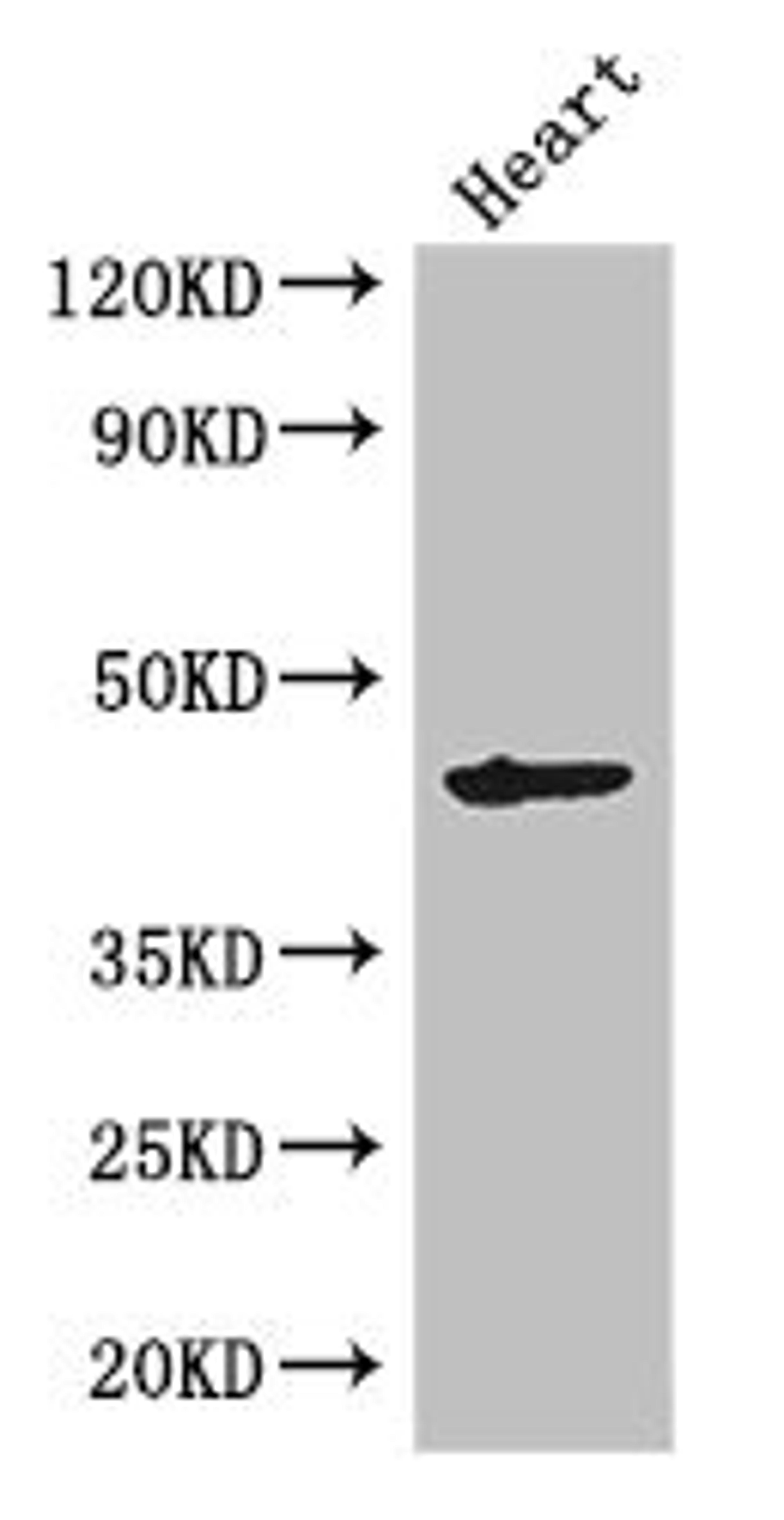 Western Blot. Positive WB detected in: Mouse heart tissue. All lanes: MEI4 antibody at 2.7ug/ml. Secondary. Goat polyclonal to rabbit IgG at 1/50000 dilution. Predicted band size: 45 kDa. Observed band size: 45 kDa.