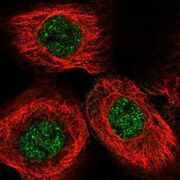 Immunocytochemistry/Immunofluorescence: SPAG17 Antibody [NBP1-93841] Staining of human cell line A-431 shows positivity in nucleus but not nucleoli.