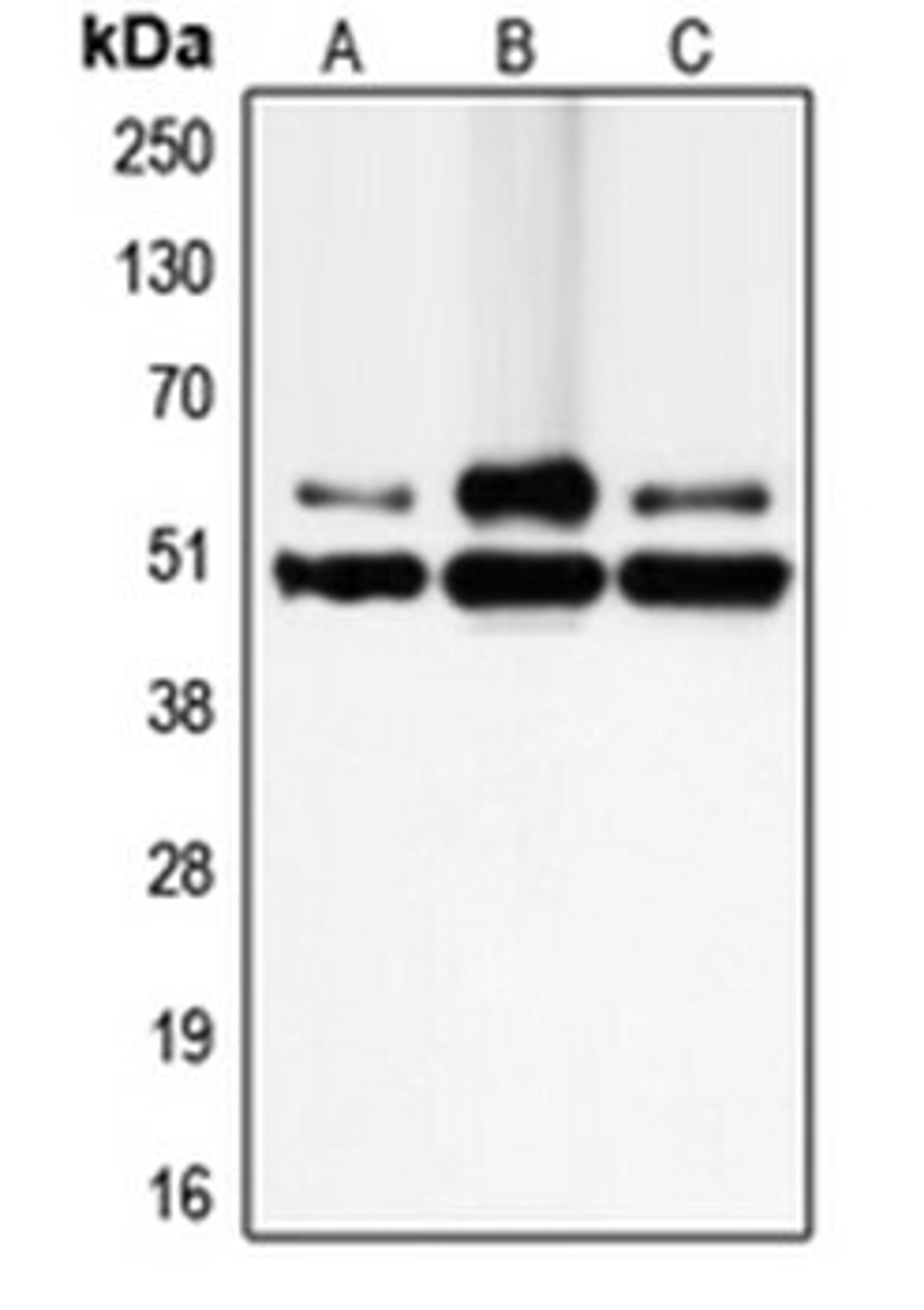 Western blot analysis of Jurkat (Lane 1), SW480 (Lane 2), K562 (Lane 3) whole cell lysates using CFLAR antibody