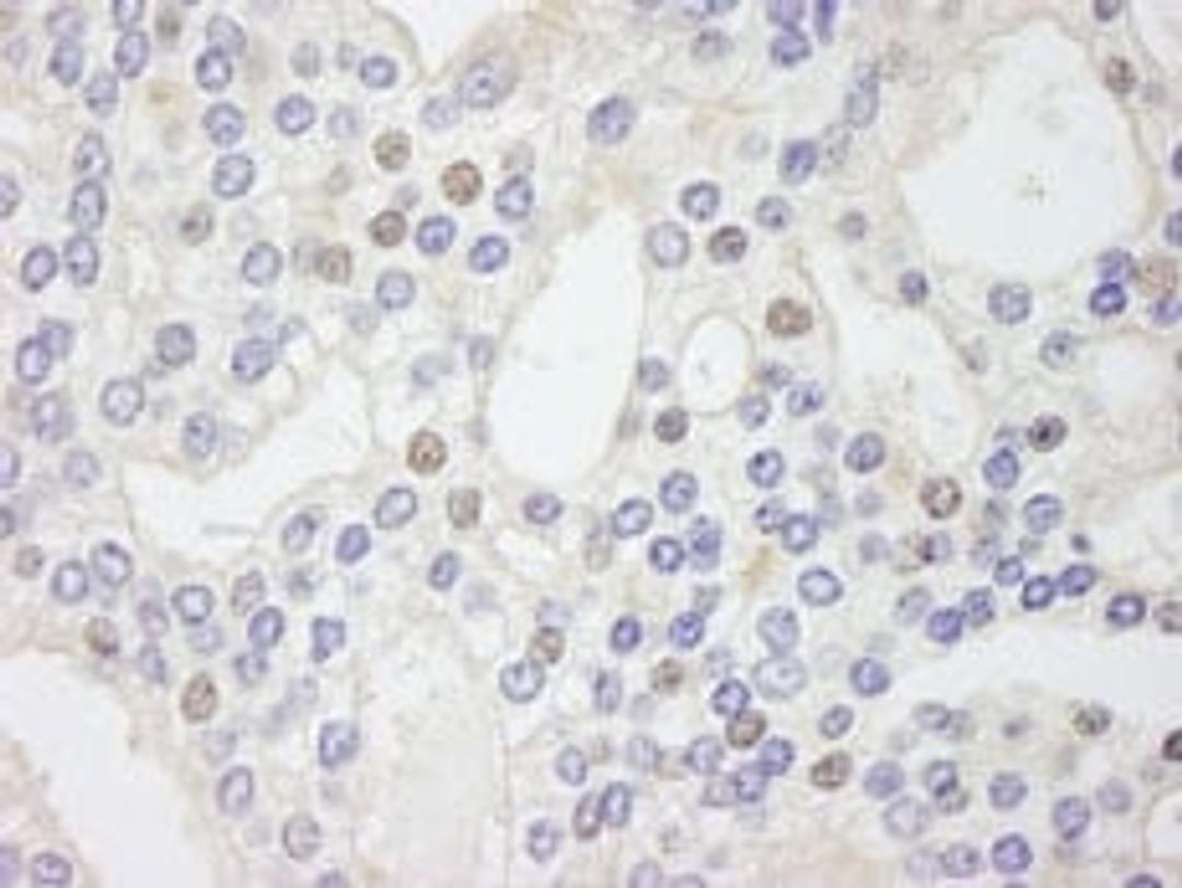 Detection of human GTF2IRD/TFII-IRD1 by immunohistochemistry.