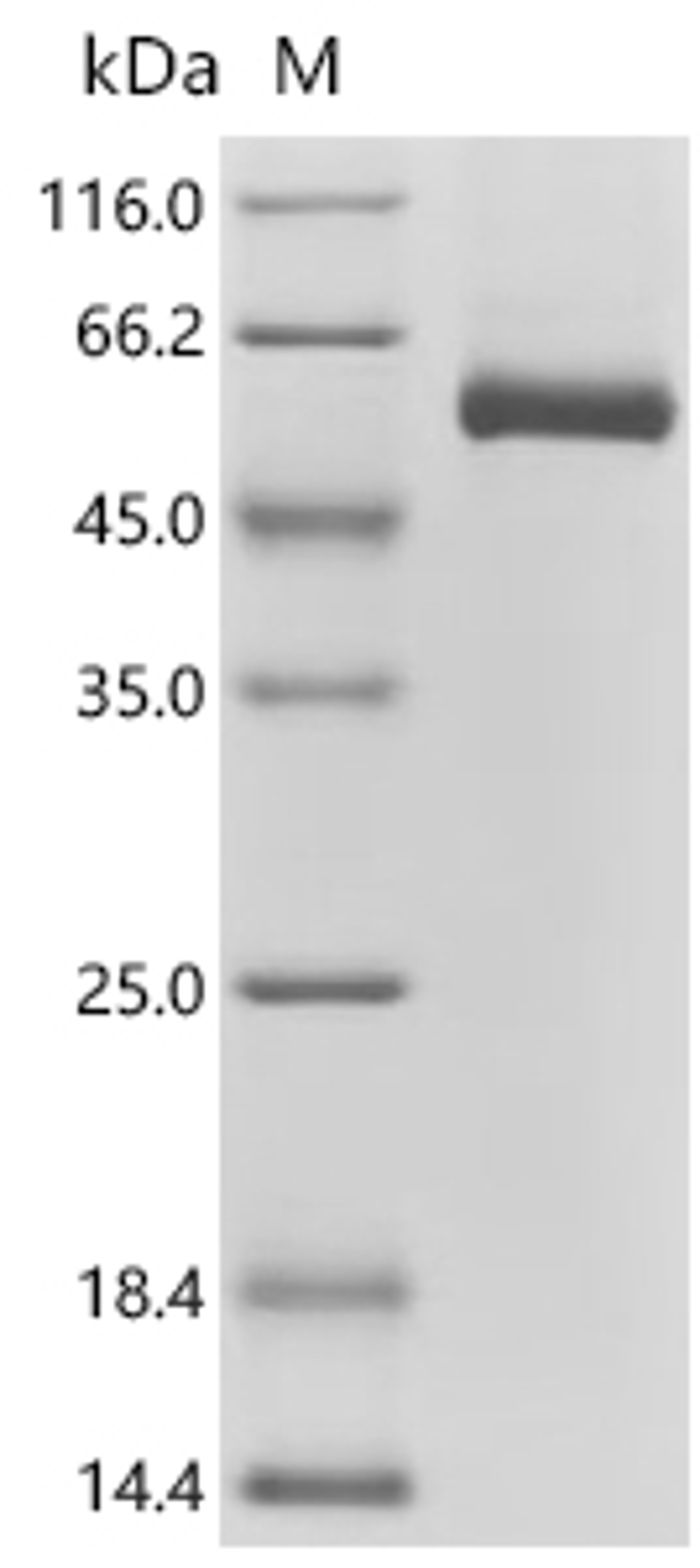 (Tris-Glycine gel) Discontinuous SDS-PAGE (reduced) with 5% enrichment gel and 15% separation gel.