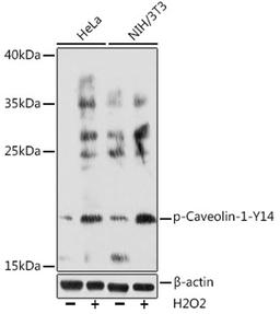 Western blot - Phospho-Caveolin-1-Y14 Rabbit pAb (AP0742)