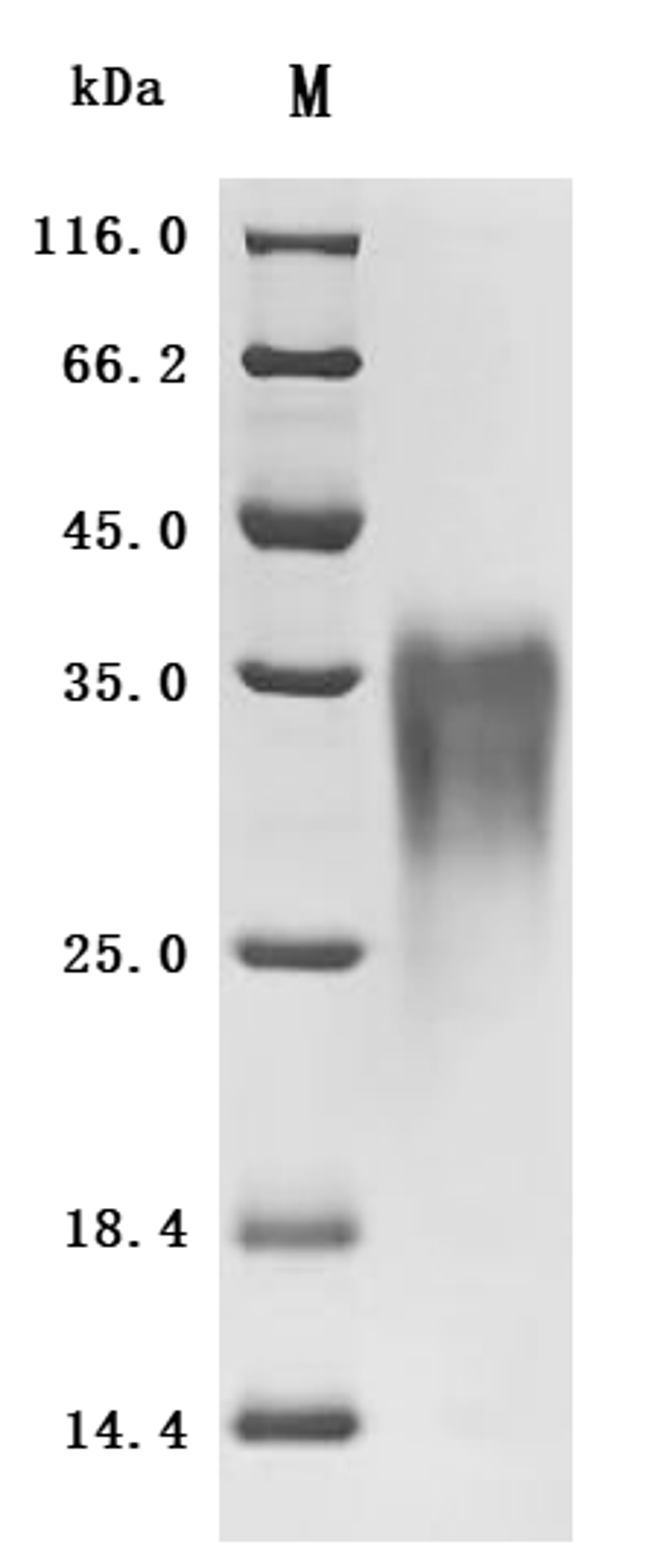 (Tris-Glycine gel) Discontinuous SDS-PAGE (reduced) with 5% enrichment gel and 15% separation gel.