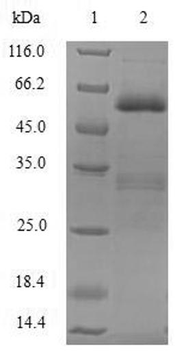 (Tris-Glycine gel) Discontinuous SDS-PAGE (reduced) with 5% enrichment gel and 15% separation gel.