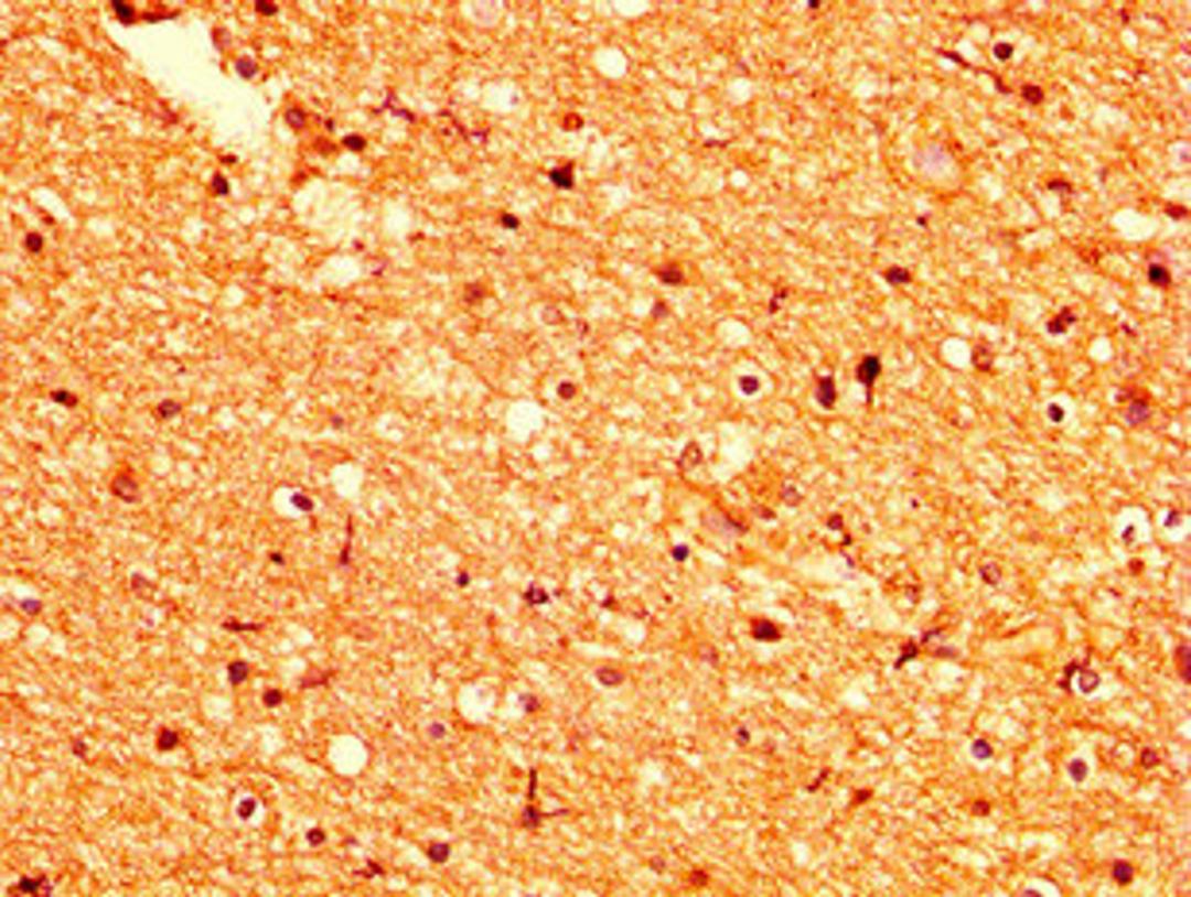 IHC image of CSB-PA735975LA01HU diluted at 1:500 and staining in paraffin-embedded human brain tissue performed on a Leica BondTM system. After dewaxing and hydration, antigen retrieval was mediated by high pressure in a citrate buffer (pH 6.0). Section was blocked with 10% normal goat serum 30min at RT. Then primary antibody (1% BSA) was incubated at 4°C overnight. The primary is detected by a biotinylated secondary antibody and visualized using an HRP conjugated SP system.