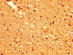 IHC image of CSB-PA735975LA01HU diluted at 1:500 and staining in paraffin-embedded human brain tissue performed on a Leica BondTM system. After dewaxing and hydration, antigen retrieval was mediated by high pressure in a citrate buffer (pH 6.0). Section was blocked with 10% normal goat serum 30min at RT. Then primary antibody (1% BSA) was incubated at 4°C overnight. The primary is detected by a biotinylated secondary antibody and visualized using an HRP conjugated SP system.