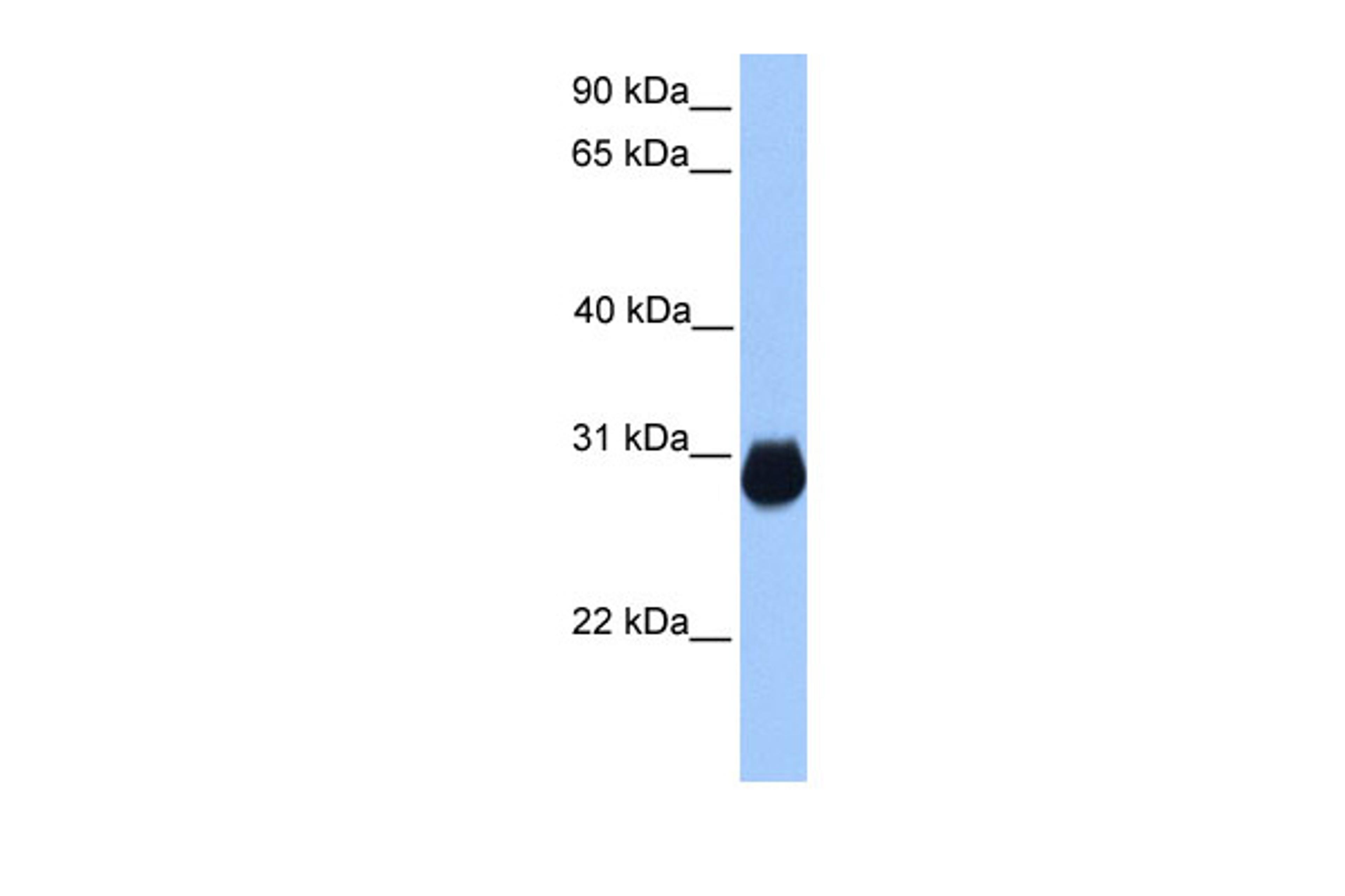 Antibody used in WB on Human Muscle at 0.2-1 ug/ml.