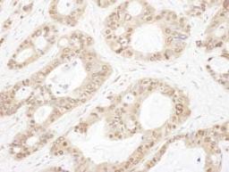 Detection of human OGFR by immunohistochemistry.