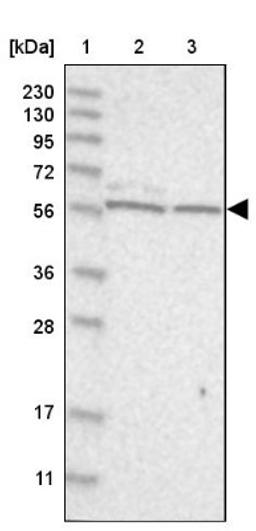 Western Blot: ICB1 Antibody [NBP1-87849] - Lane 1: Marker [kDa] 230, 130, 95, 72, 56, 36, 28, 17, 11<br/>Lane 2: Human cell line RT-4<br/>Lane 3: Human cell line U-251MG sp