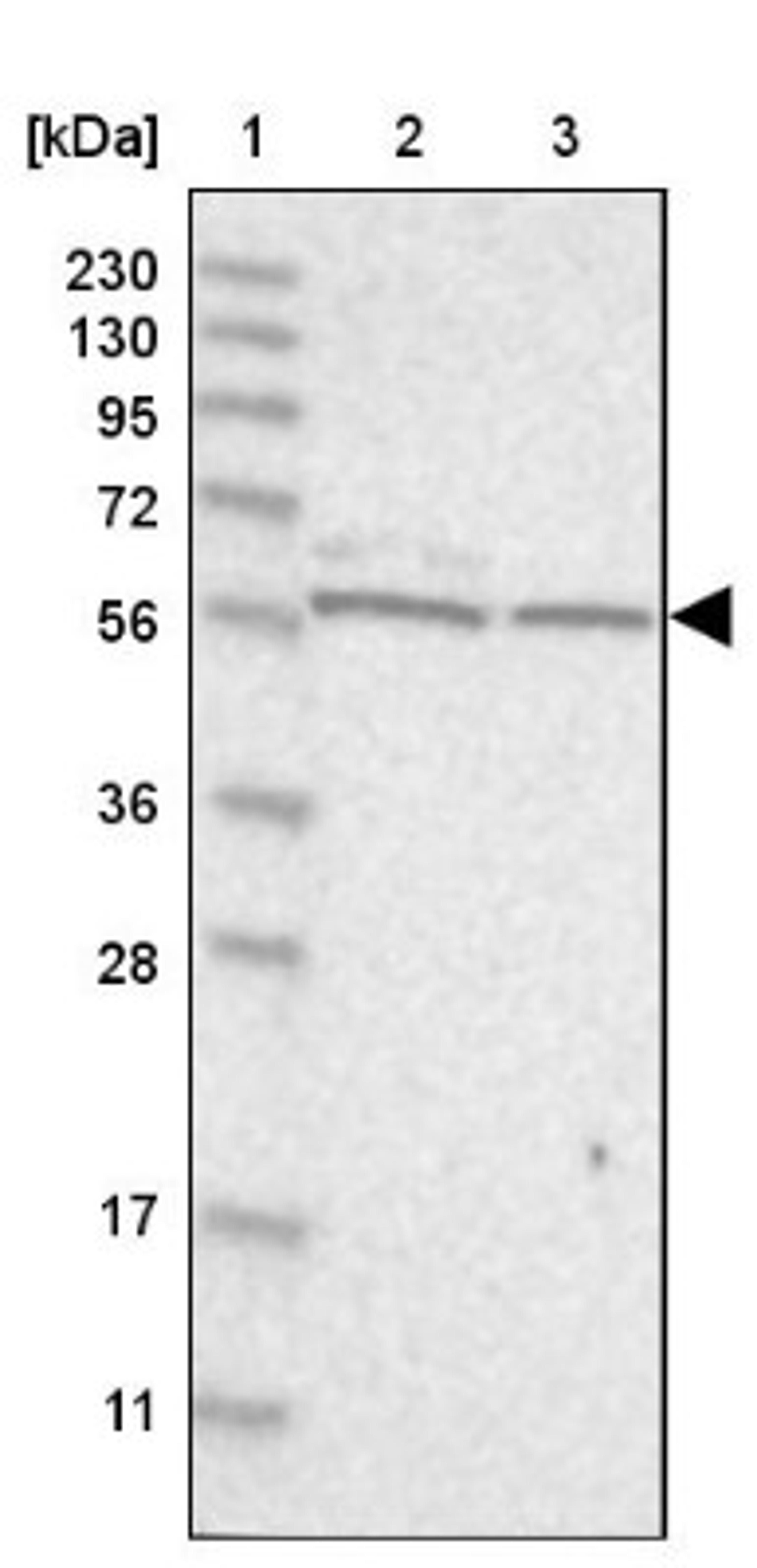 Western Blot: ICB1 Antibody [NBP1-87849] - Lane 1: Marker [kDa] 230, 130, 95, 72, 56, 36, 28, 17, 11<br/>Lane 2: Human cell line RT-4<br/>Lane 3: Human cell line U-251MG sp