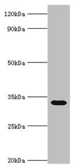 Western blot. All lanes: Erythrocyte band 7 integral membrane protein antibody at 5ug/ml + Mouse liver tissue. Secondary. Goat polyclonal to rabbit IgG at 1/10000 dilution. Predicted band size: 32, 14 kDa. Observed band size: 32 kDa.