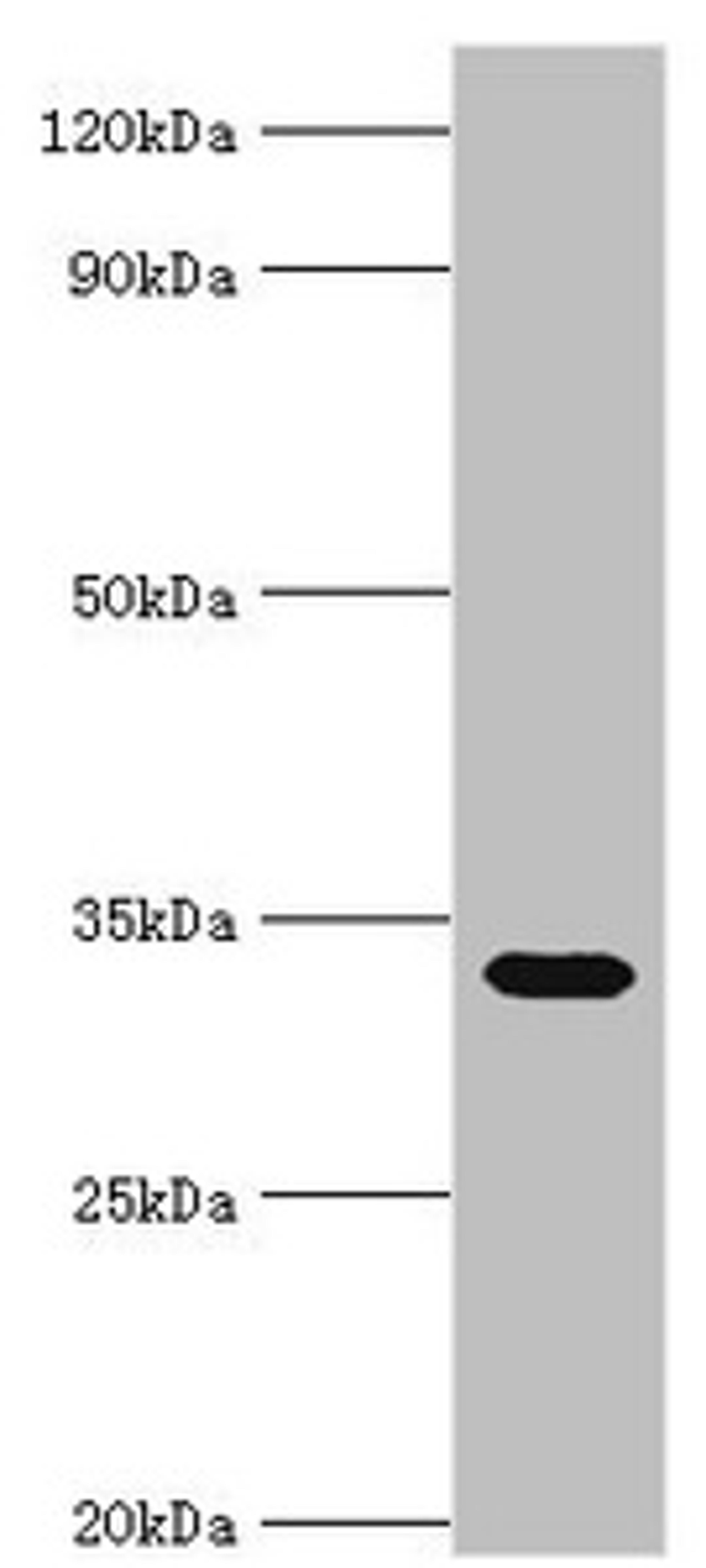 Western blot. All lanes: Erythrocyte band 7 integral membrane protein antibody at 5ug/ml + Mouse liver tissue. Secondary. Goat polyclonal to rabbit IgG at 1/10000 dilution. Predicted band size: 32, 14 kDa. Observed band size: 32 kDa.